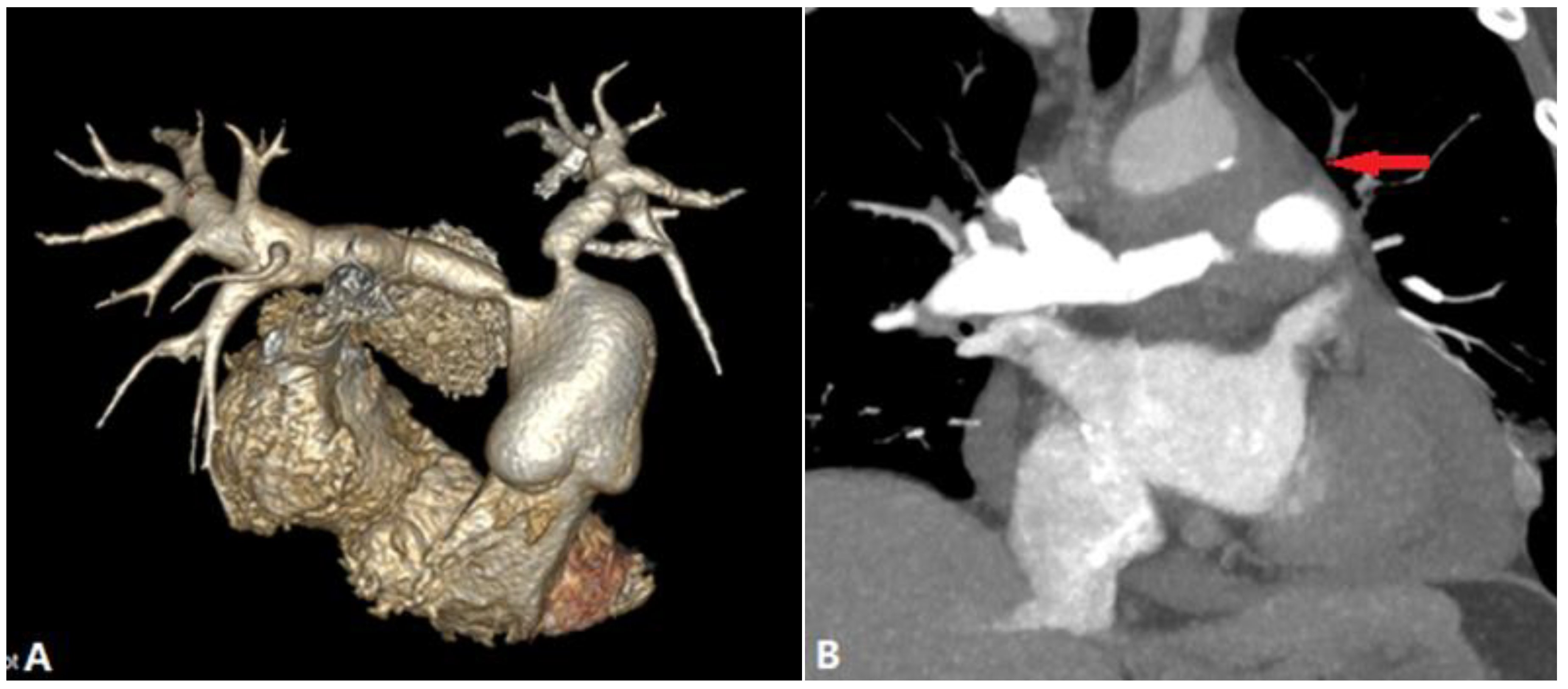 Diagnostics 14 01762 g018