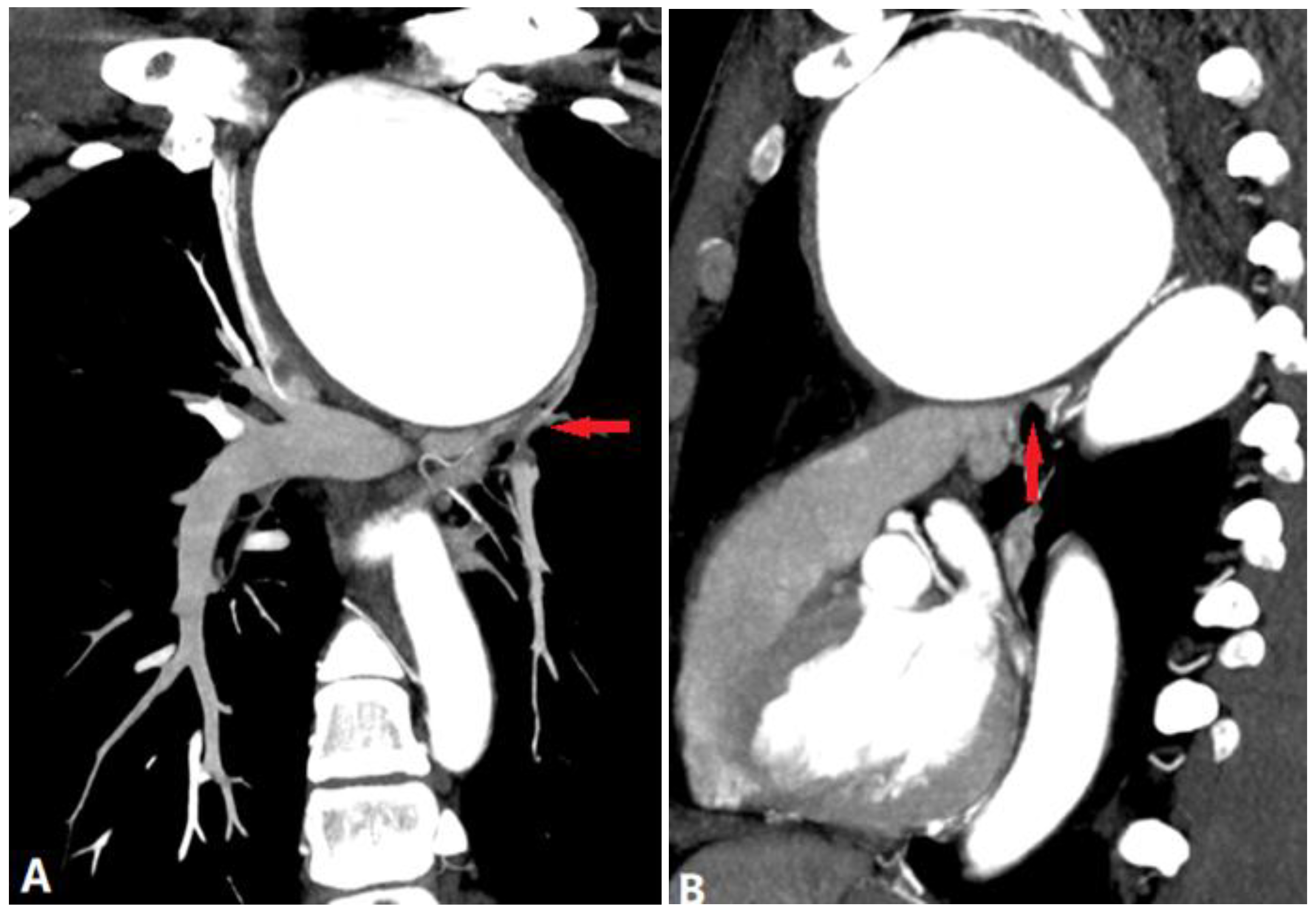 Diagnostics 14 01762 g020