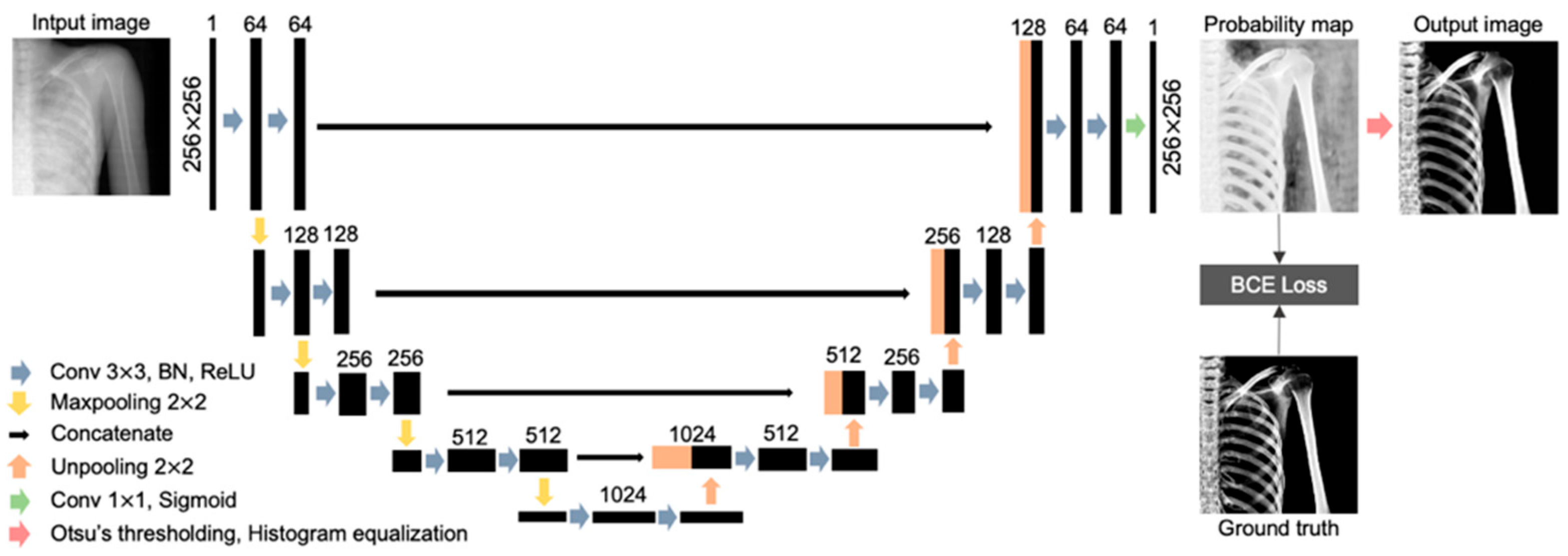 Gray-Scale Extraction of Bone Features from Chest Radiographs Based on ...