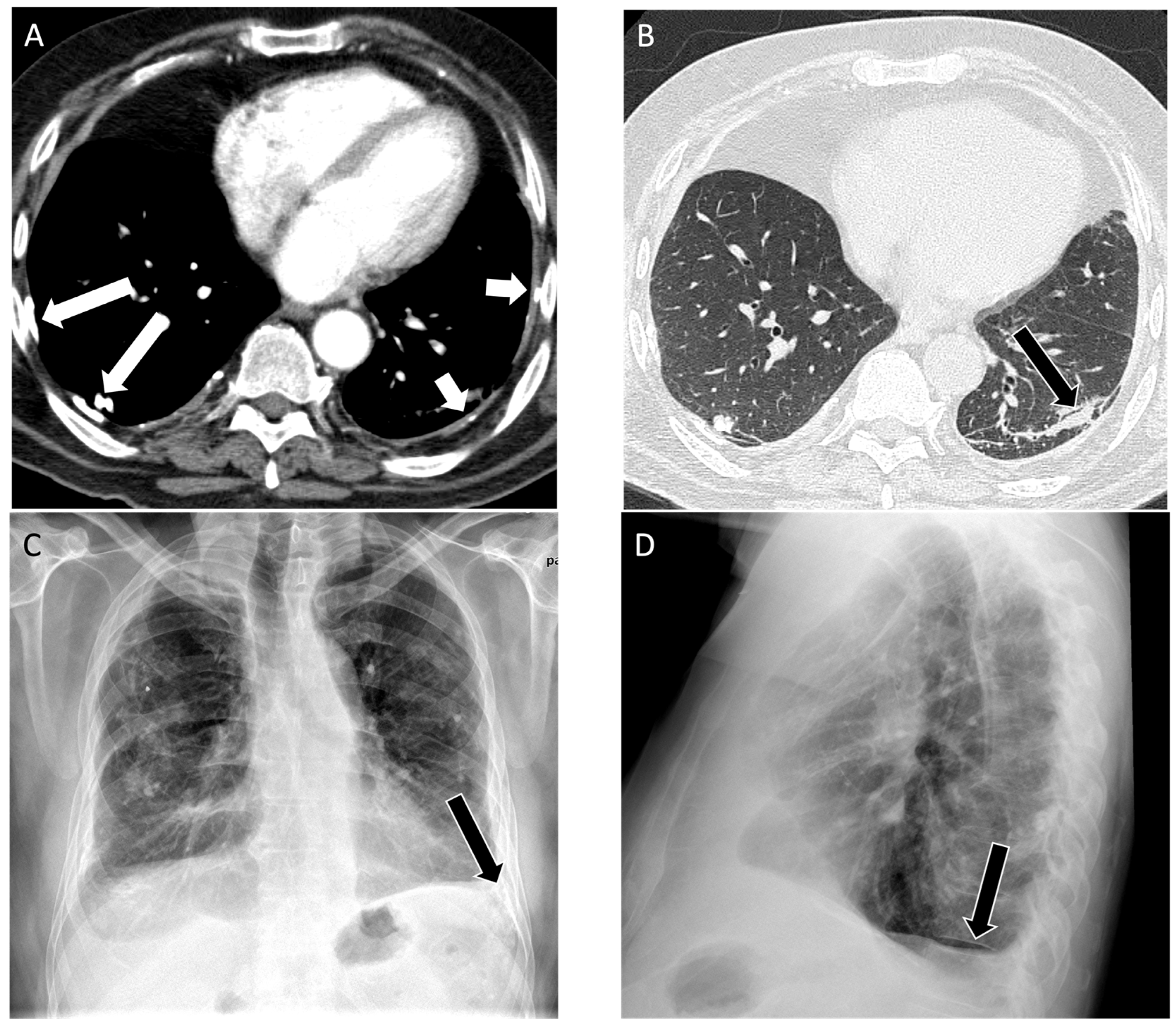 Diagnostics 14 01786 g002 Diagnostics 14 01786 g002