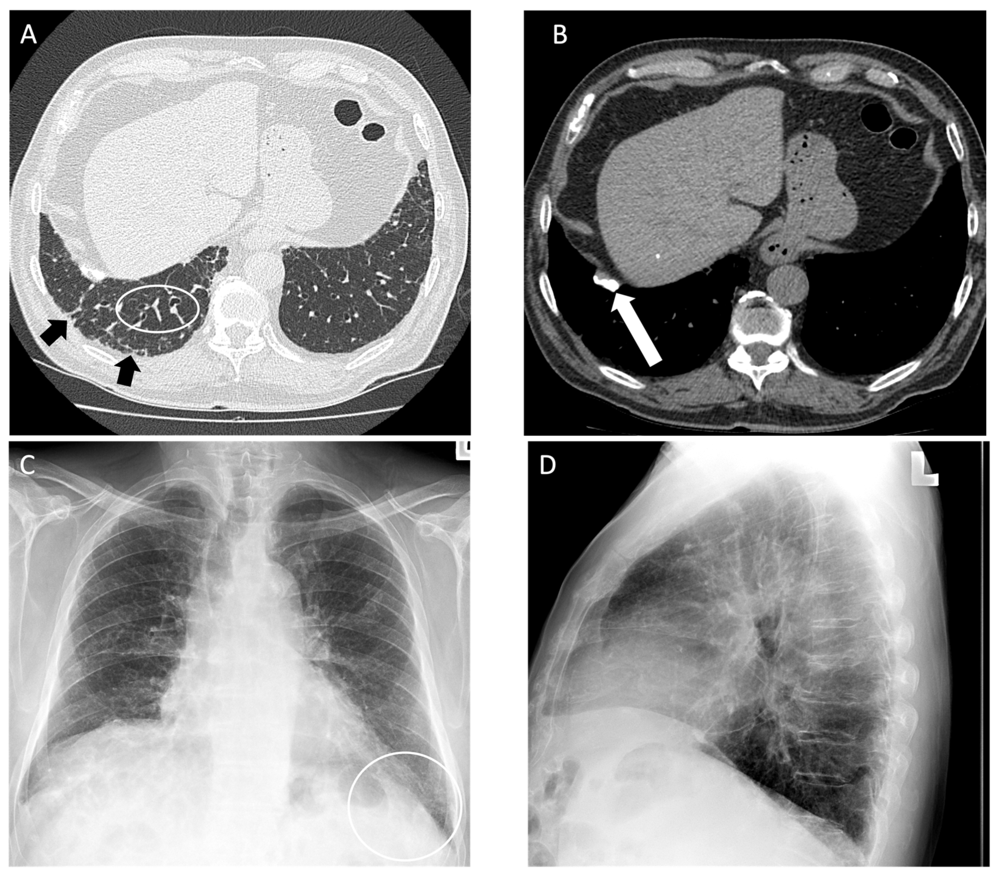 Diagnostics 14 01786 g003 Diagnostics 14 01786 g003