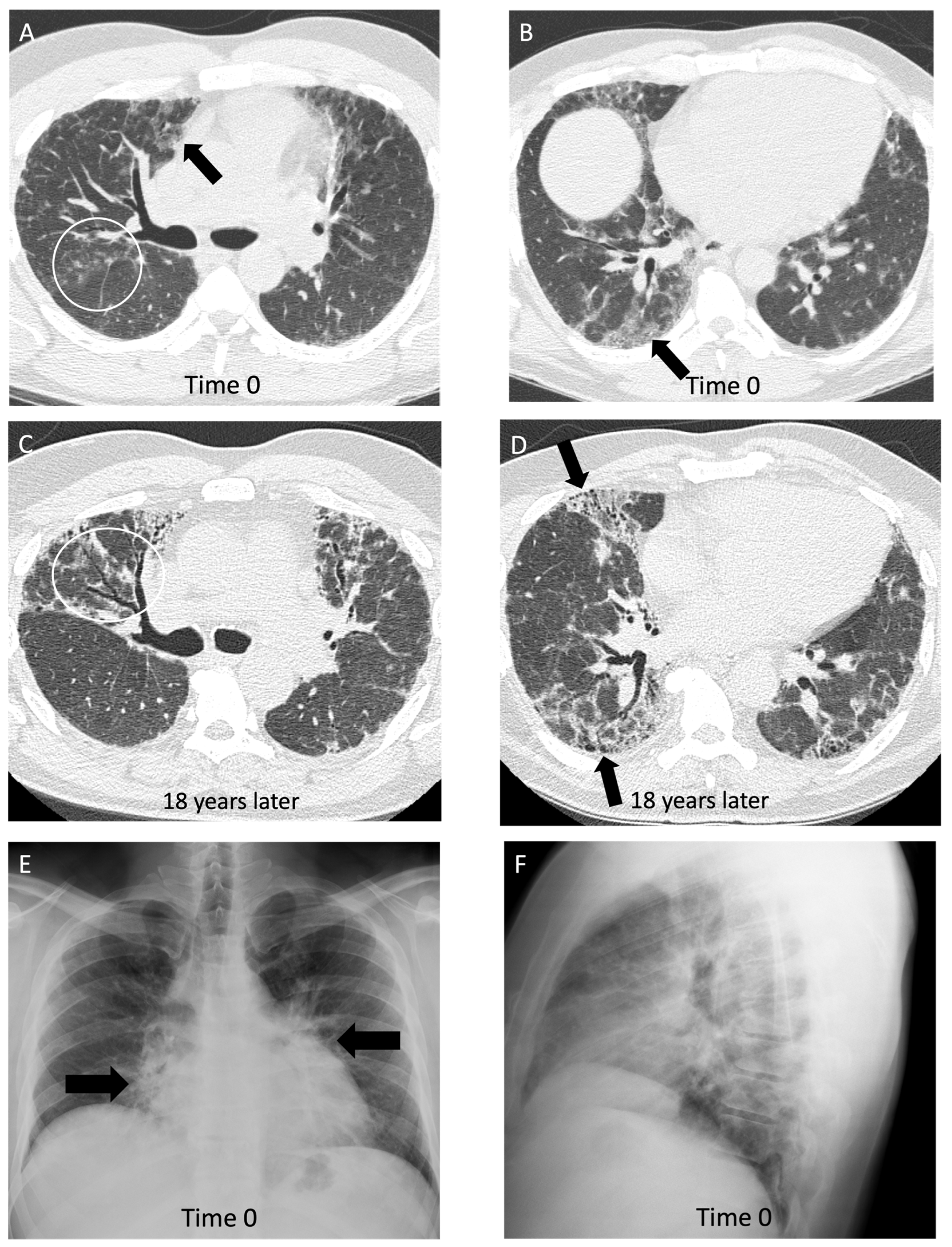Diagnostics 14 01786 g005a Diagnostics 14 01786 g005a