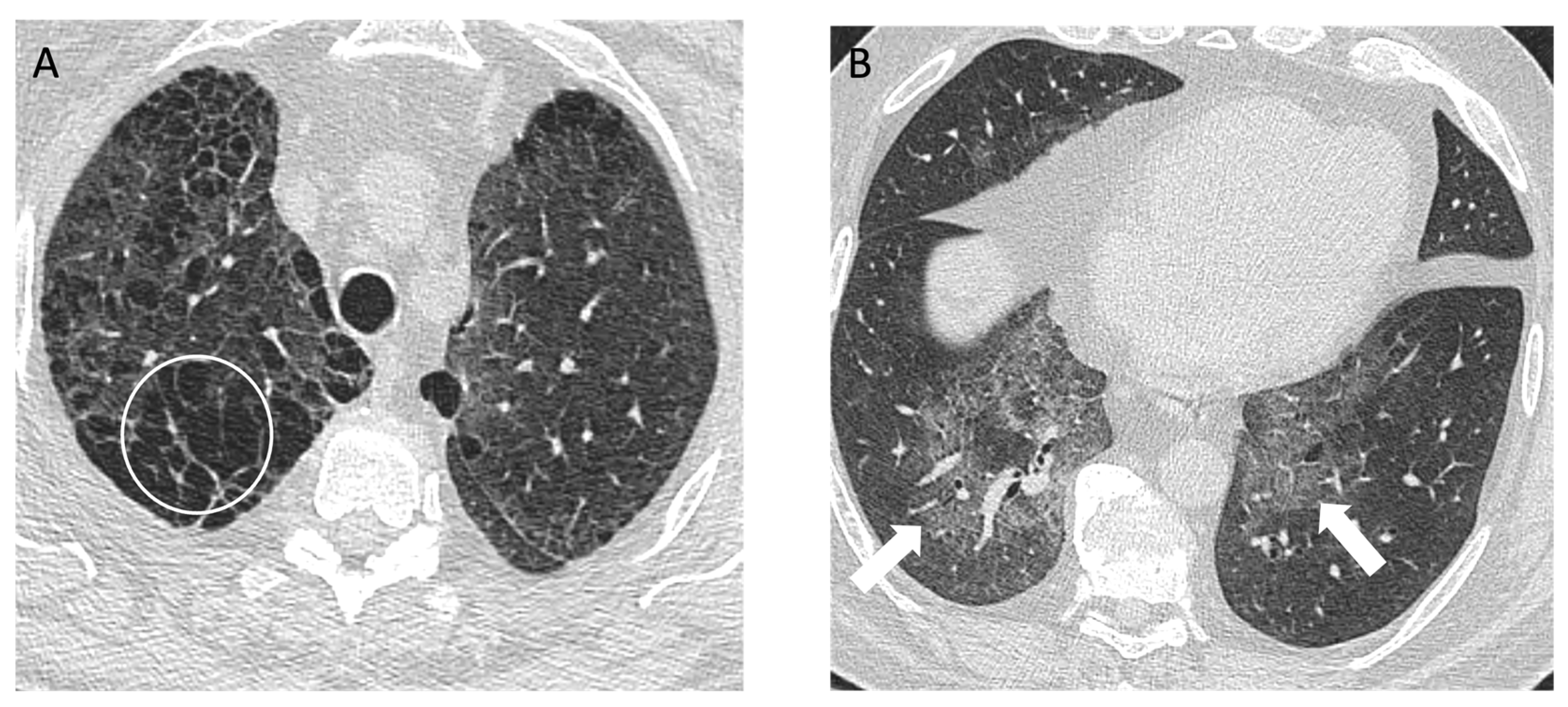 Diagnostics 14 01786 g006a Diagnostics 14 01786 g006a