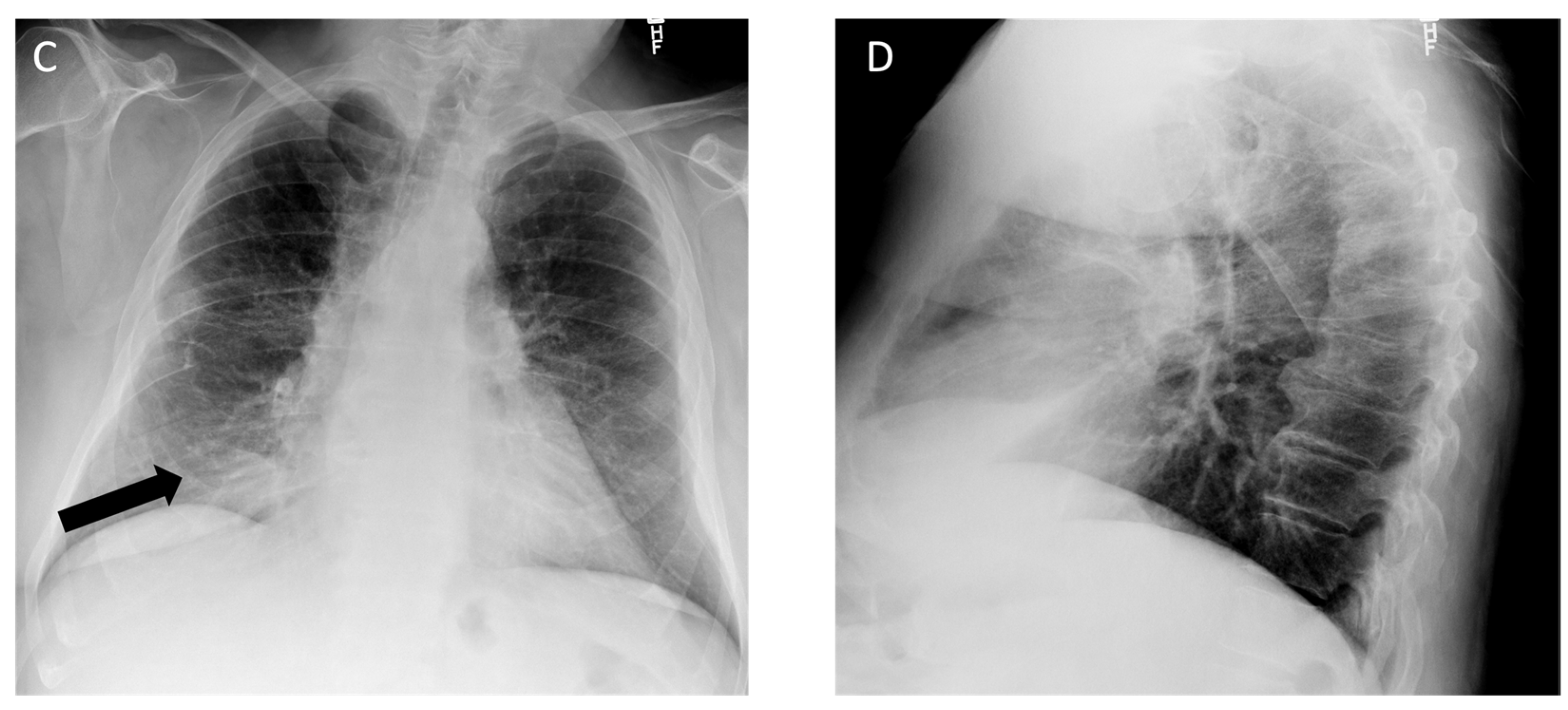 Diagnostics 14 01786 g006b Diagnostics 14 01786 g006b