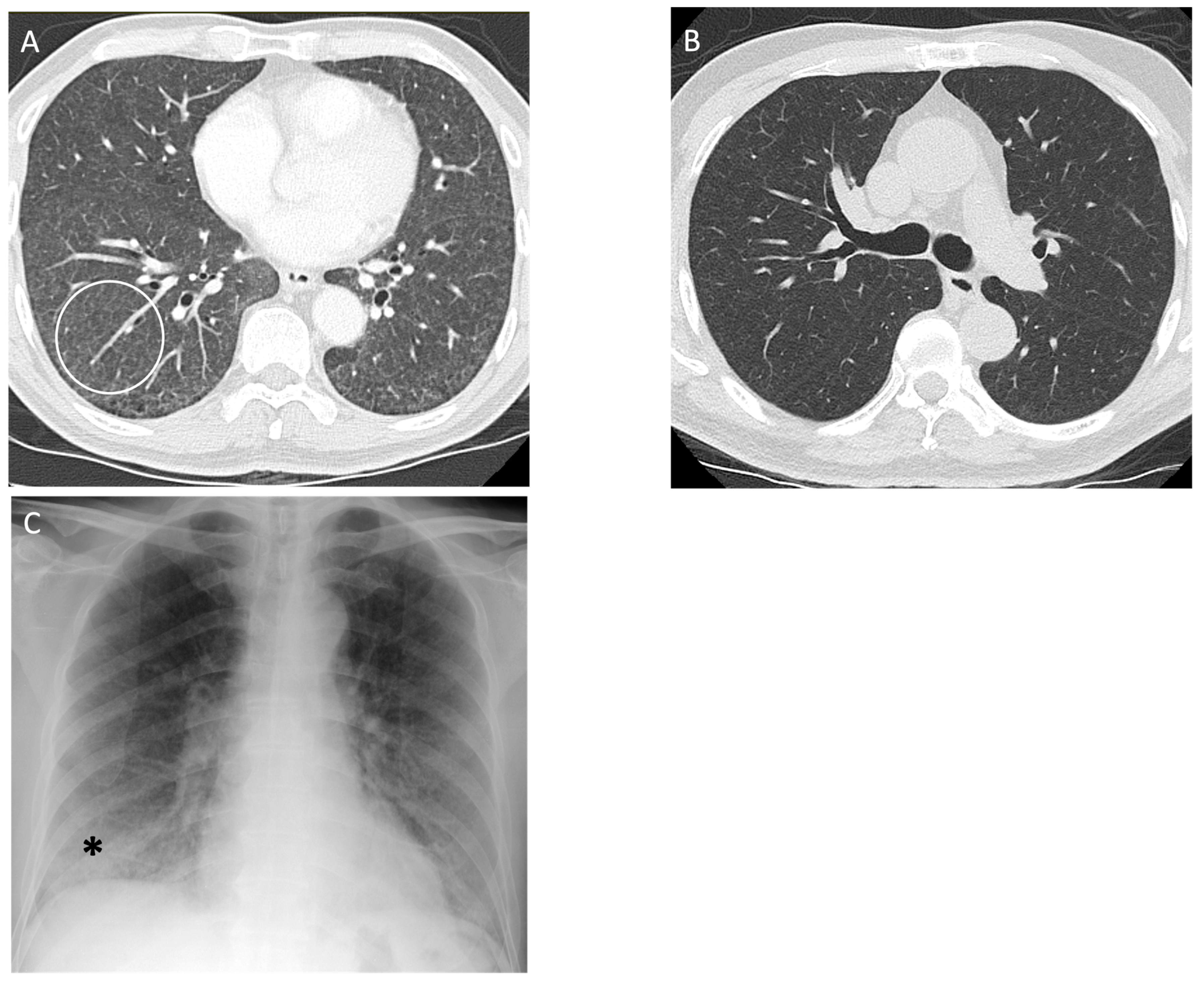 Diagnostics 14 01786 g008 Diagnostics 14 01786 g008