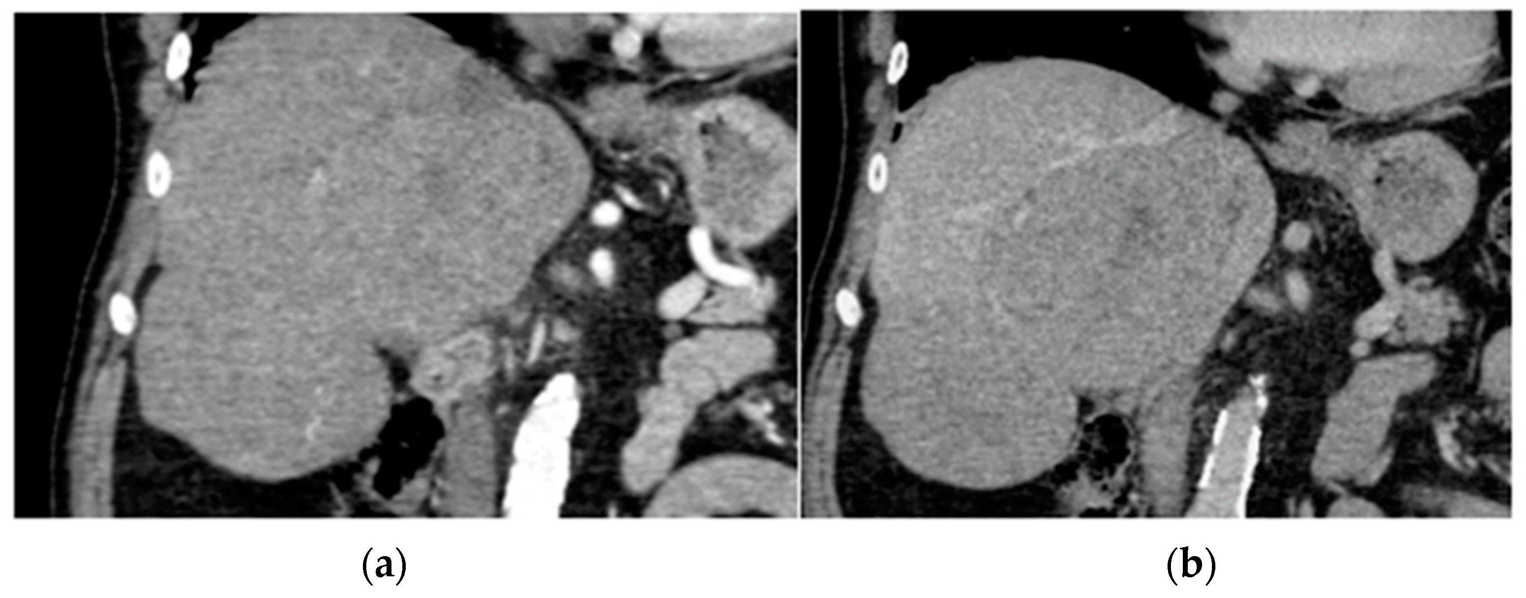 Diagnostics 14 01788 g004 Diagnostics 14 01788 g004