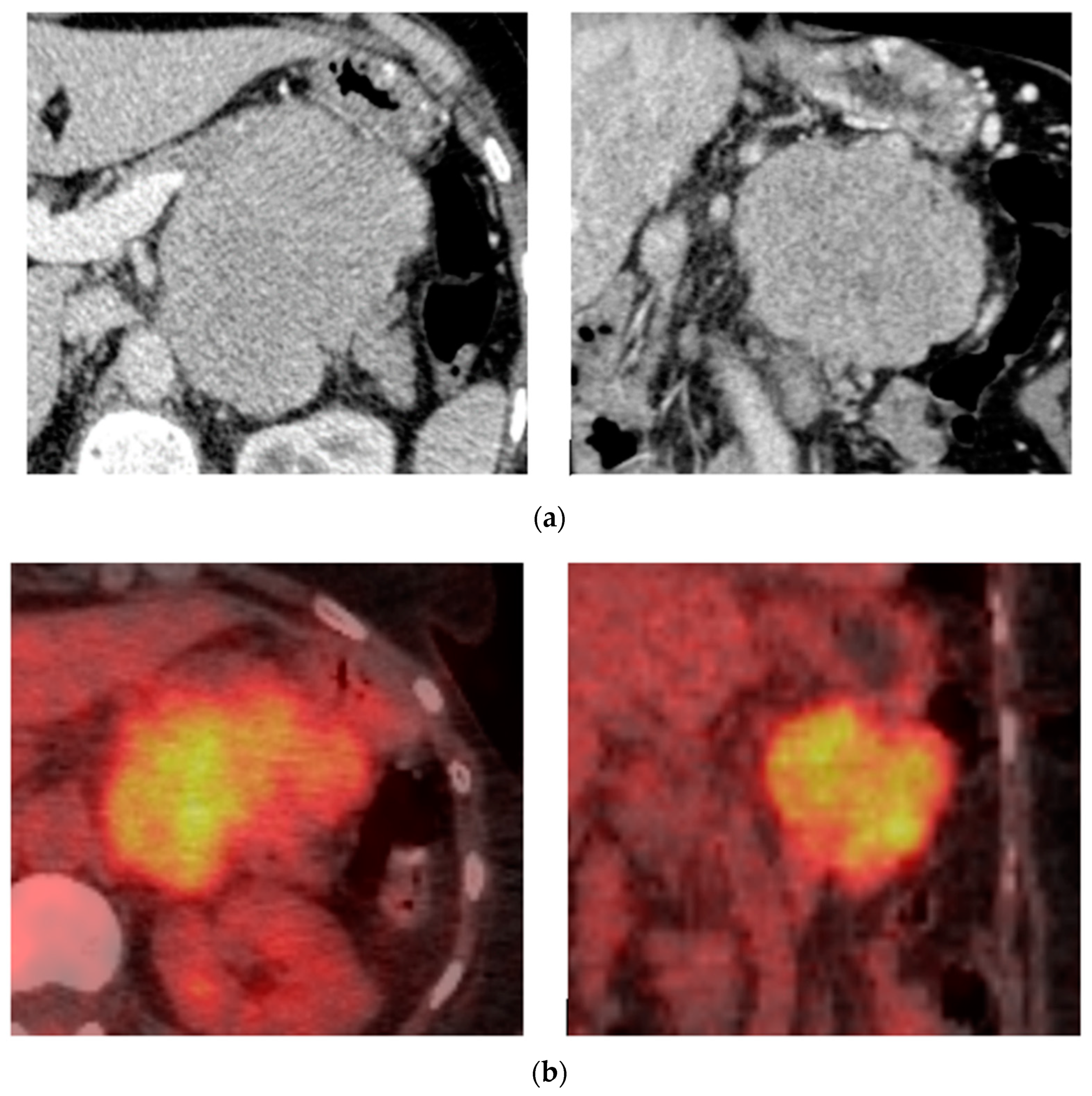 Diagnostics 14 01788 g005 Diagnostics 14 01788 g005