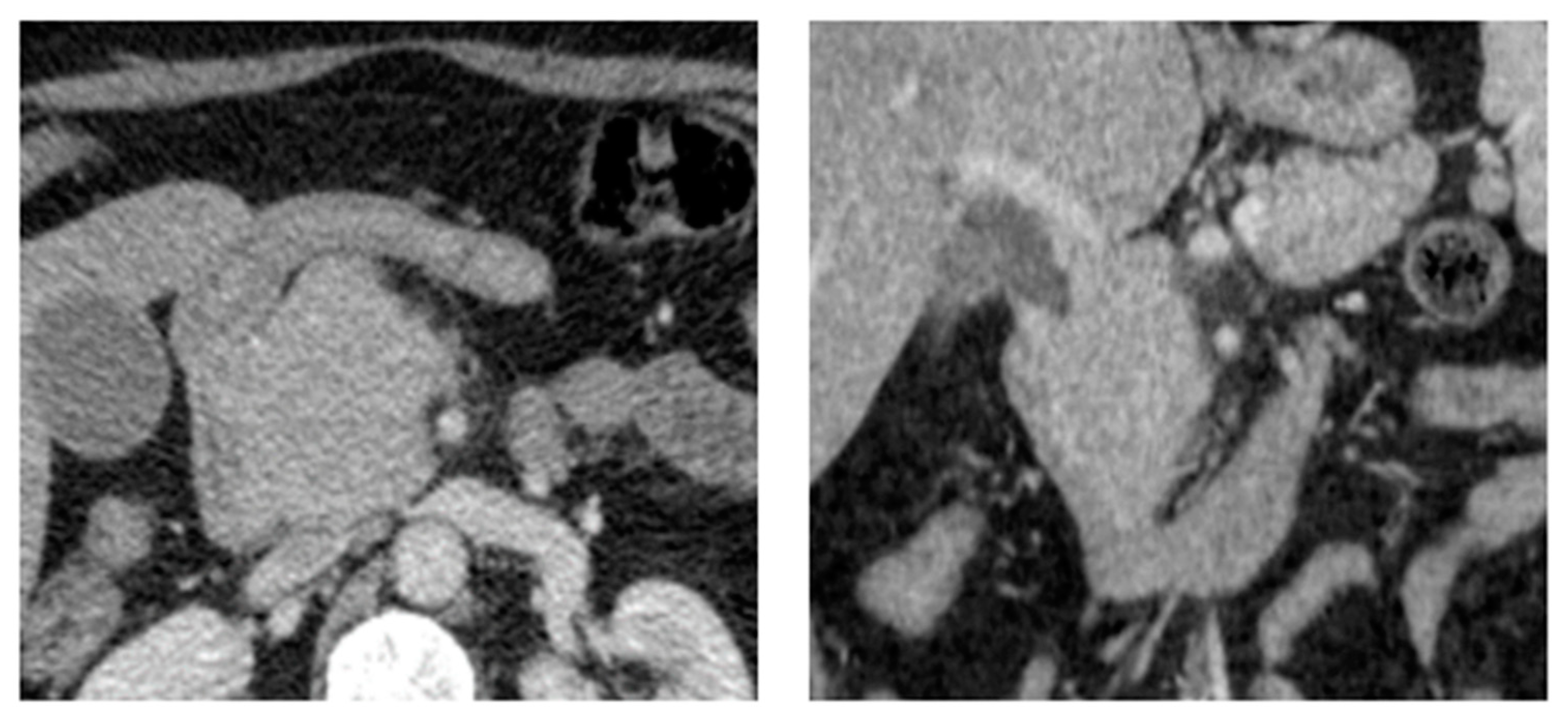 Diagnostics 14 01788 g006 Diagnostics 14 01788 g006