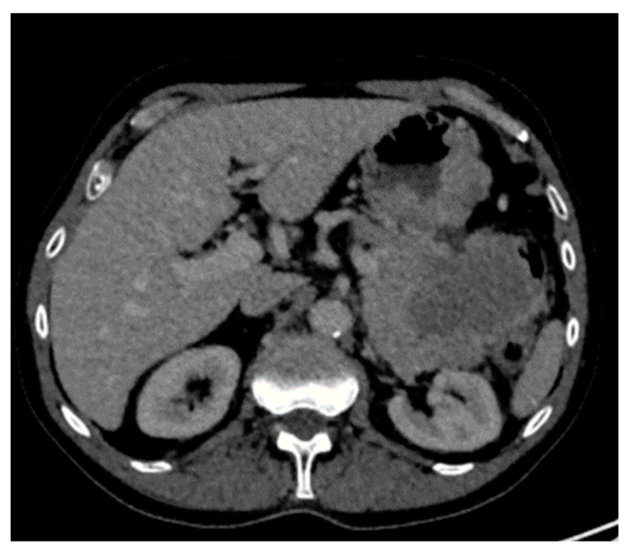 Diagnostics 14 01788 g007 Diagnostics 14 01788 g007