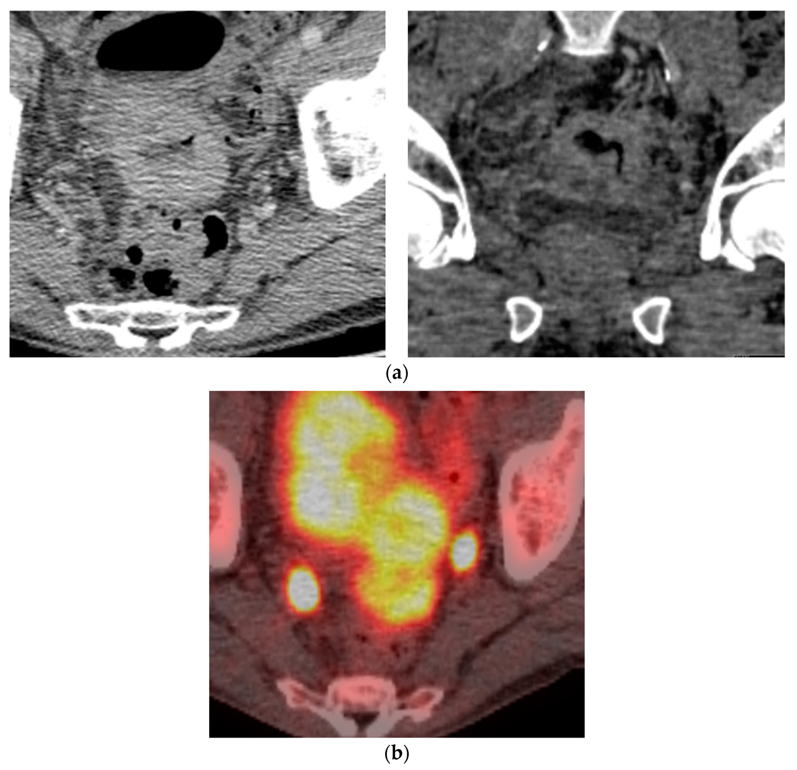 Diagnostics 14 01788 g008 Diagnostics 14 01788 g008