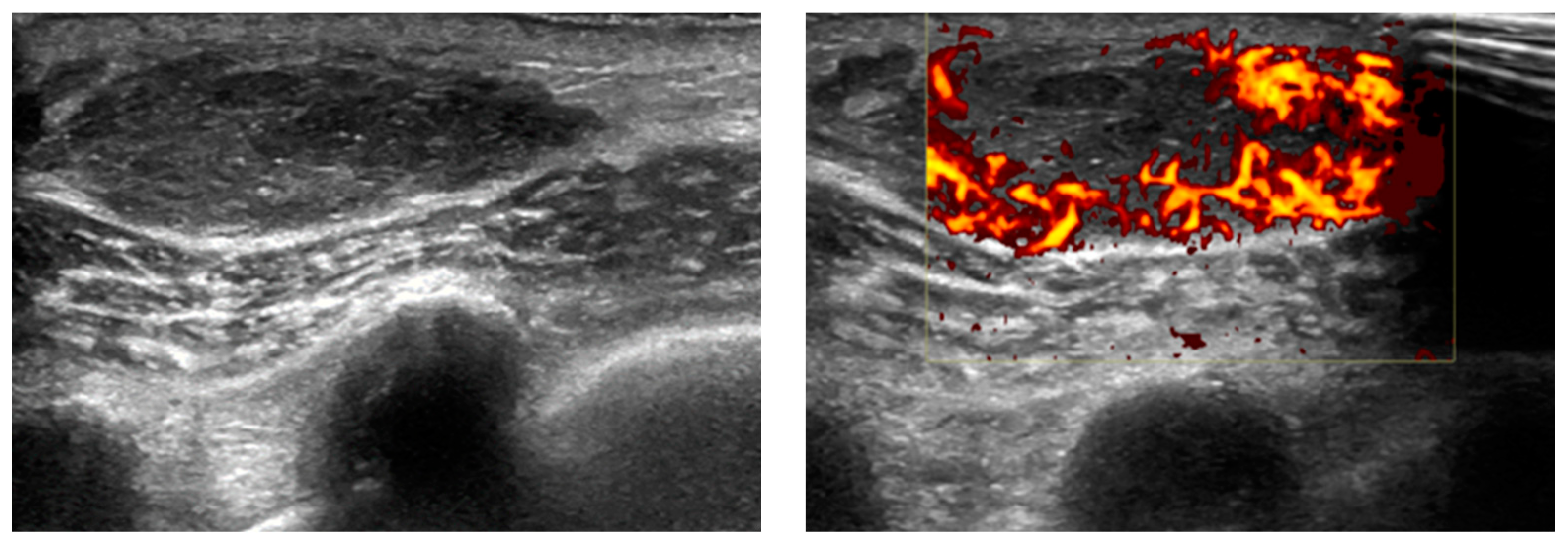 Diagnostics 14 01788 g010 Diagnostics 14 01788 g010