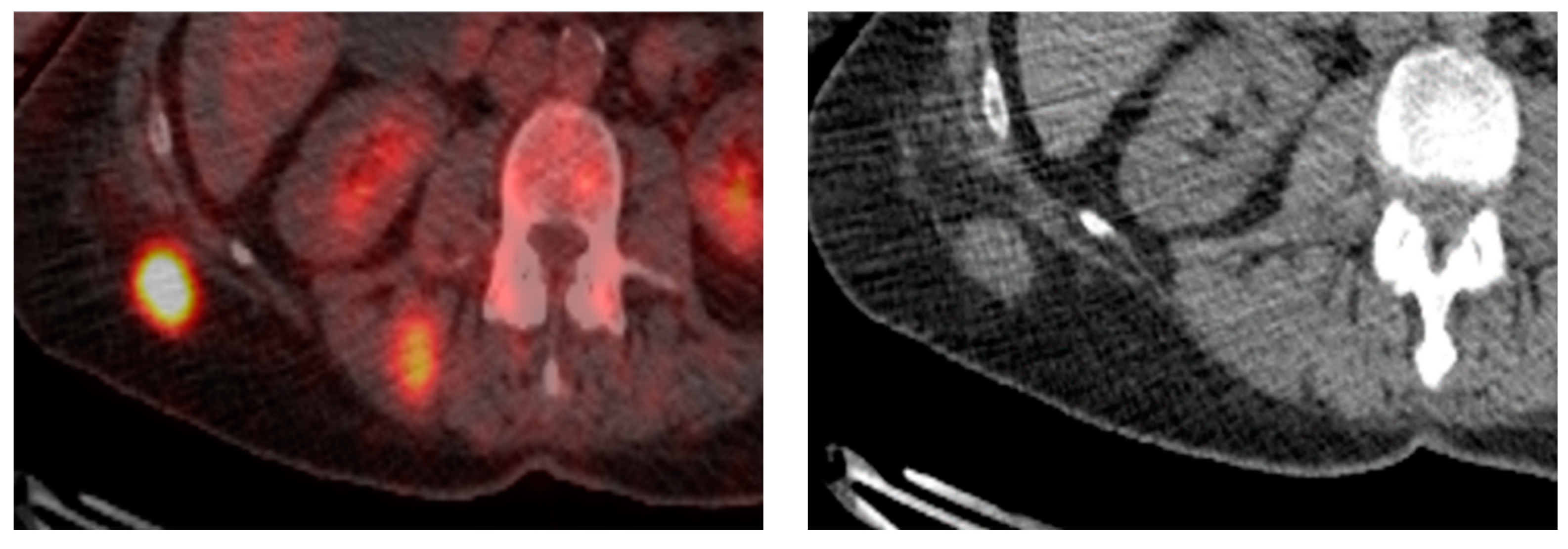 Diagnostics 14 01788 g011 Diagnostics 14 01788 g011