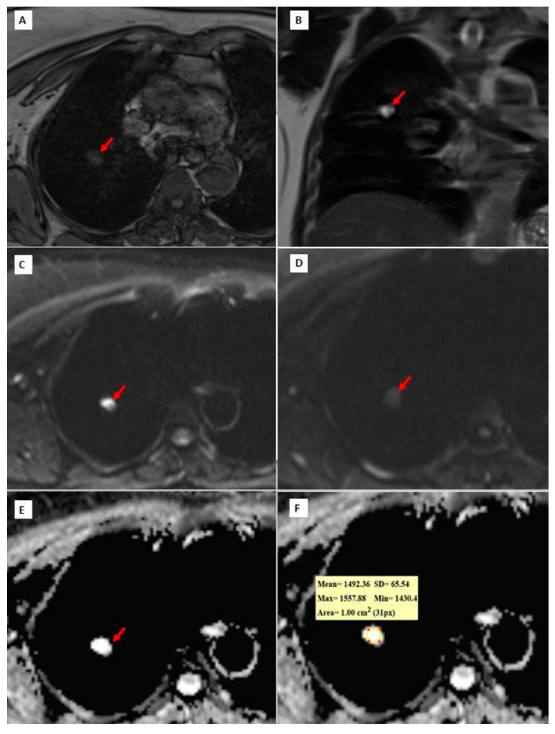 Diagnostics 14 01795 g003