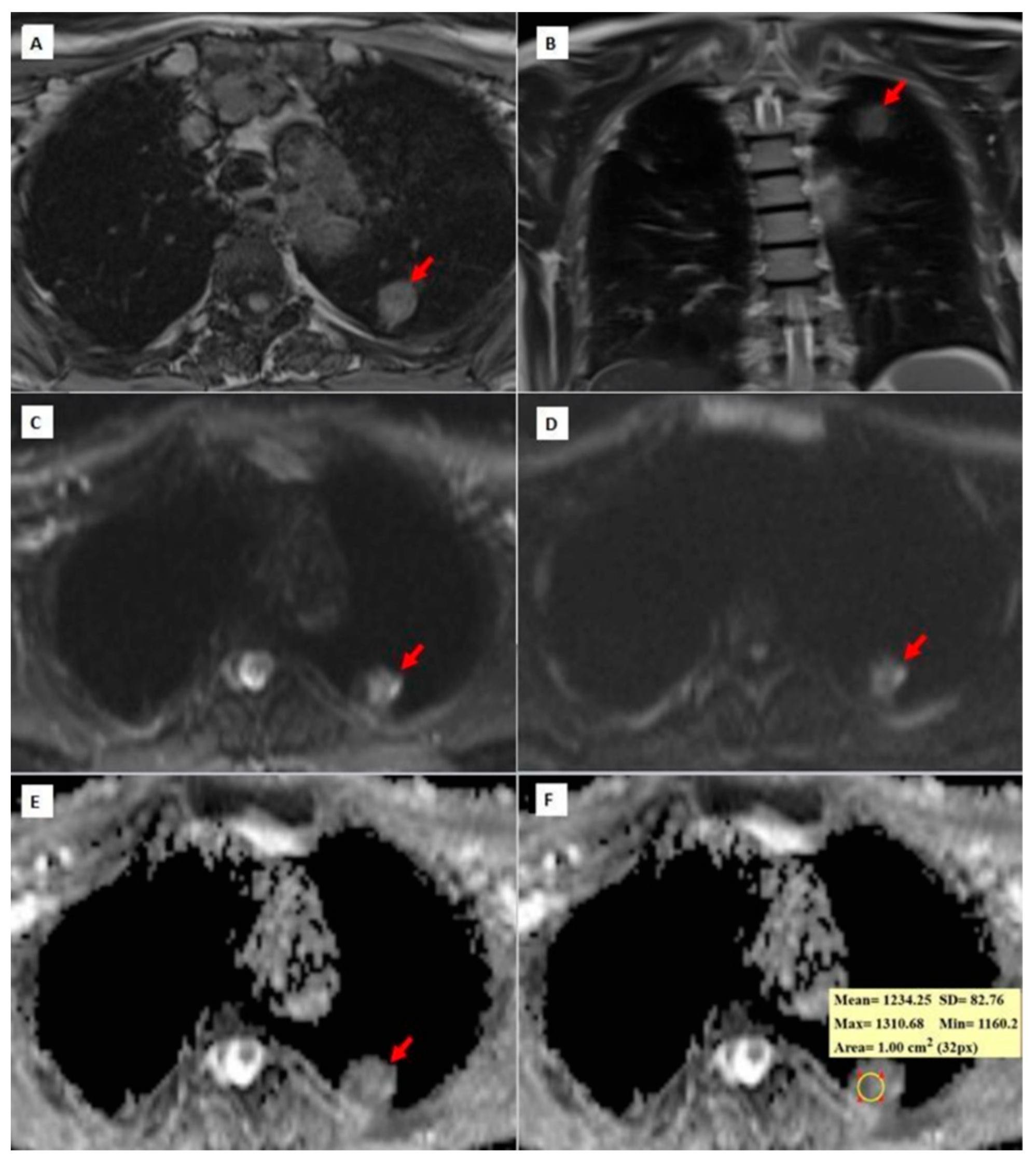 Diagnostics 14 01795 g004