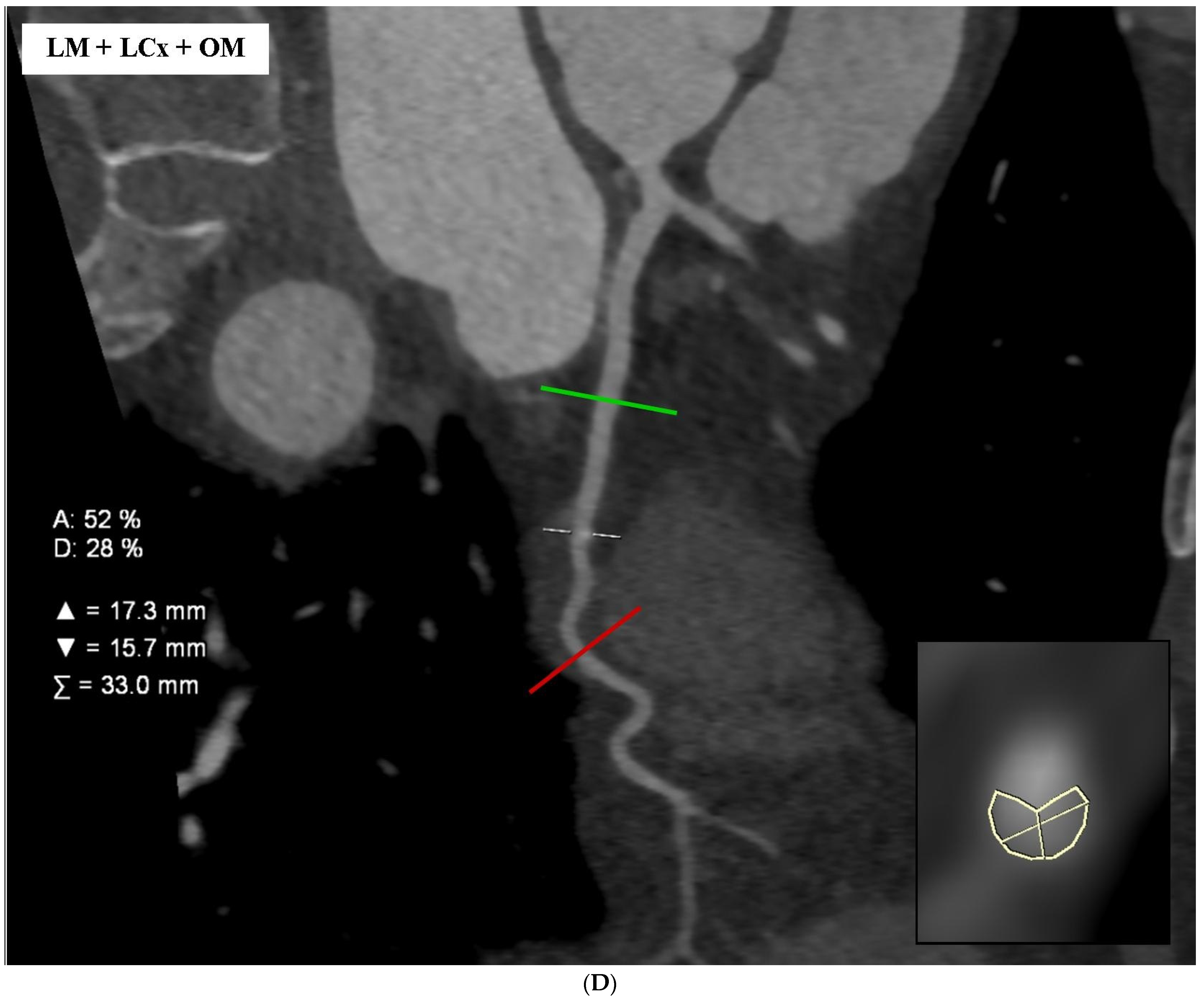 Diagnostics 14 01798 g001c