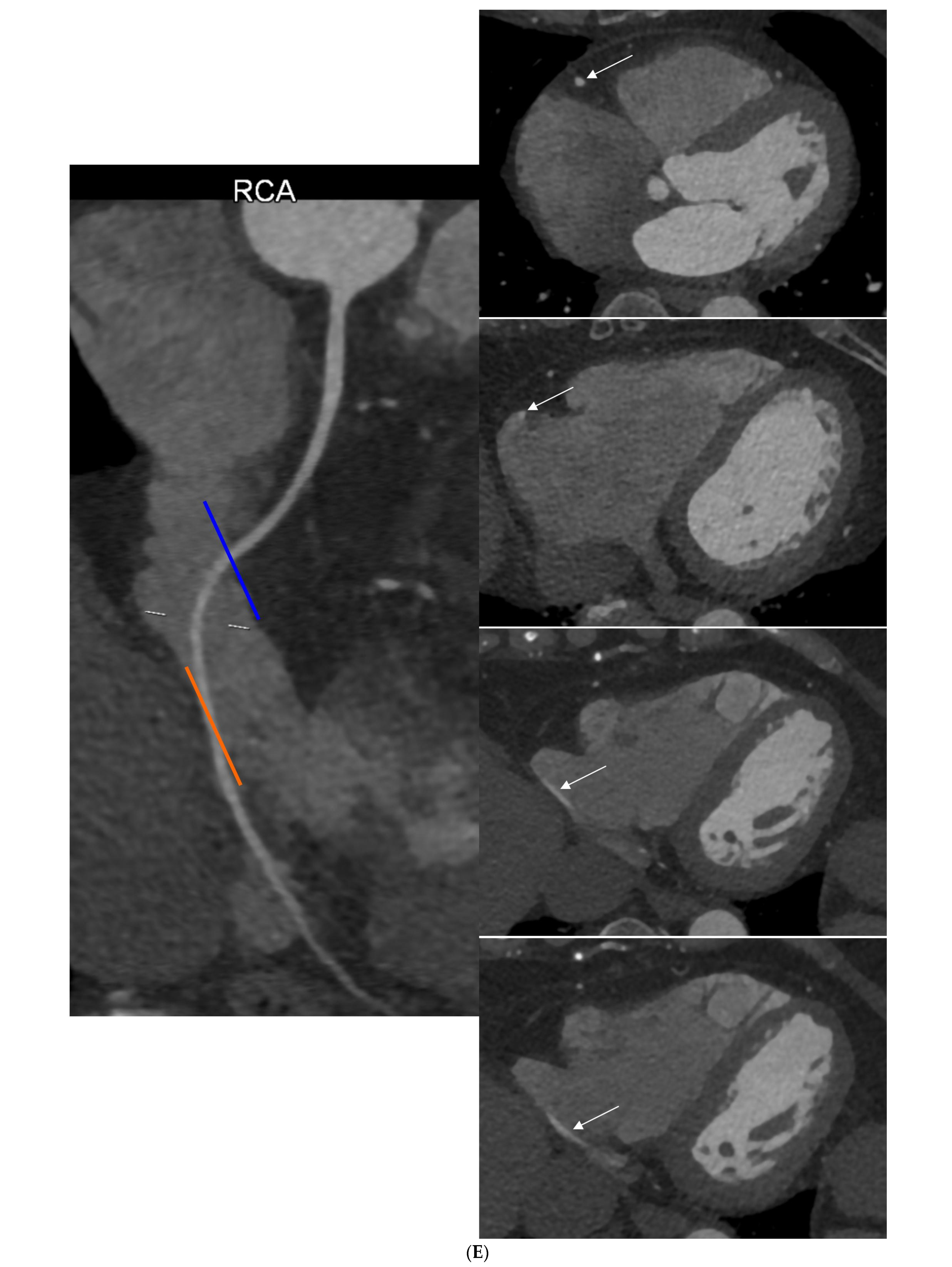 Diagnostics 14 01798 g001d