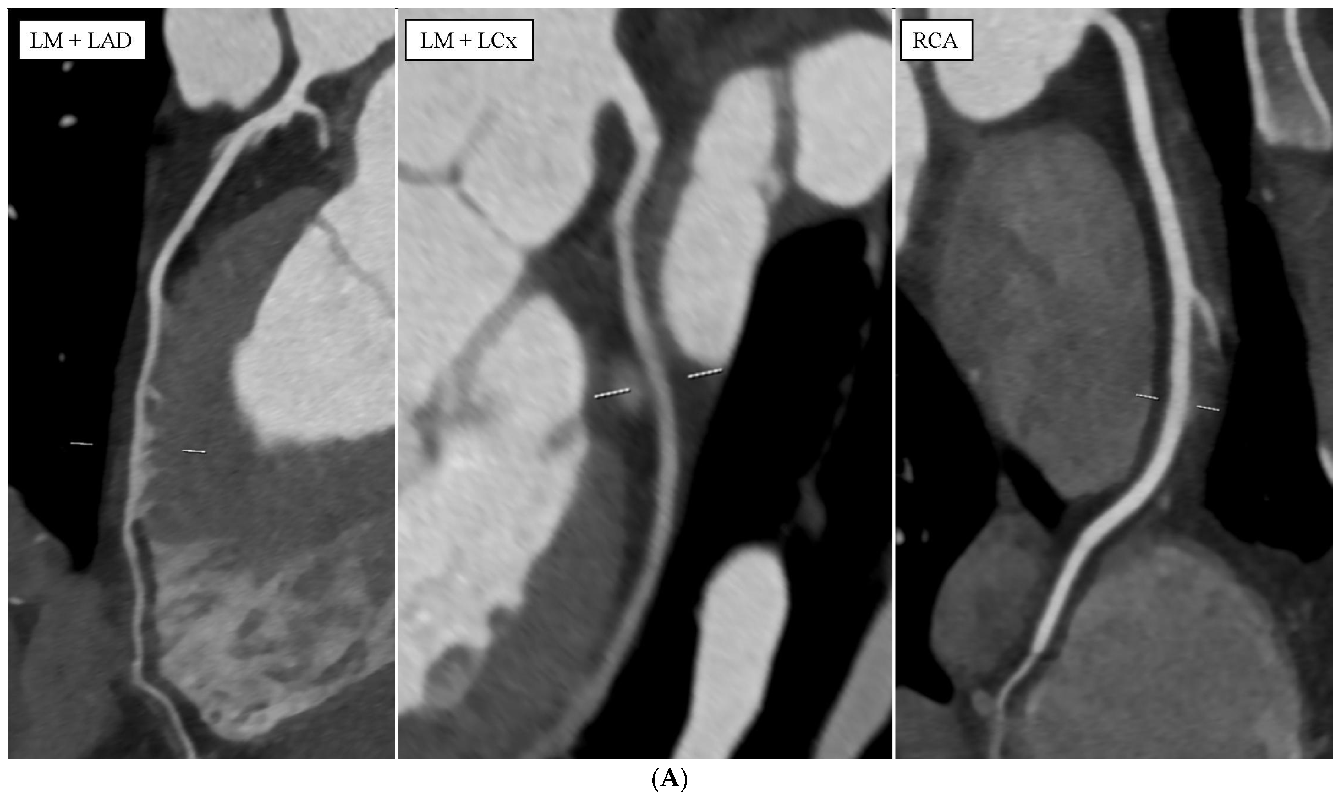 Diagnostics 14 01798 g002a