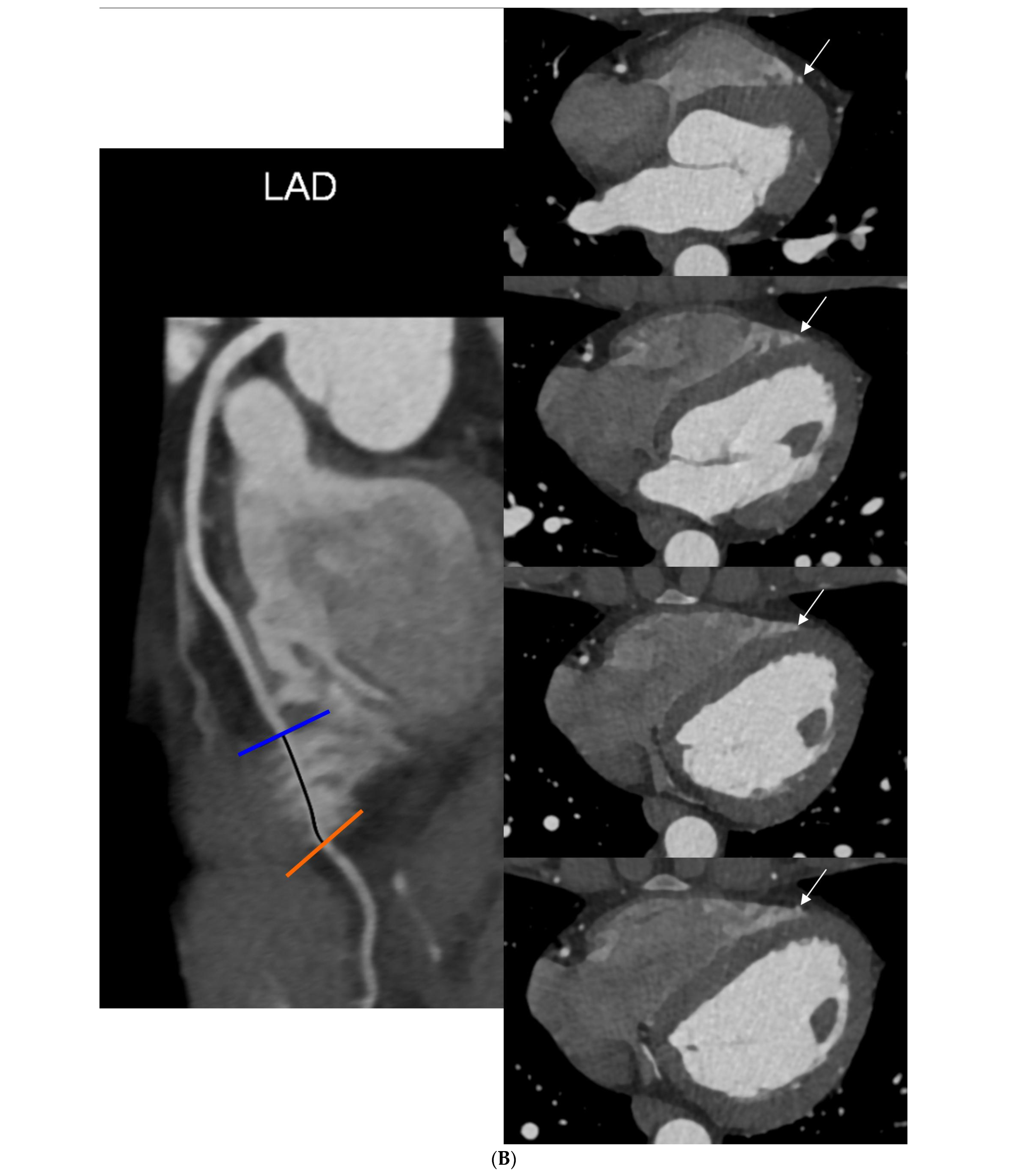 Diagnostics 14 01798 g002b