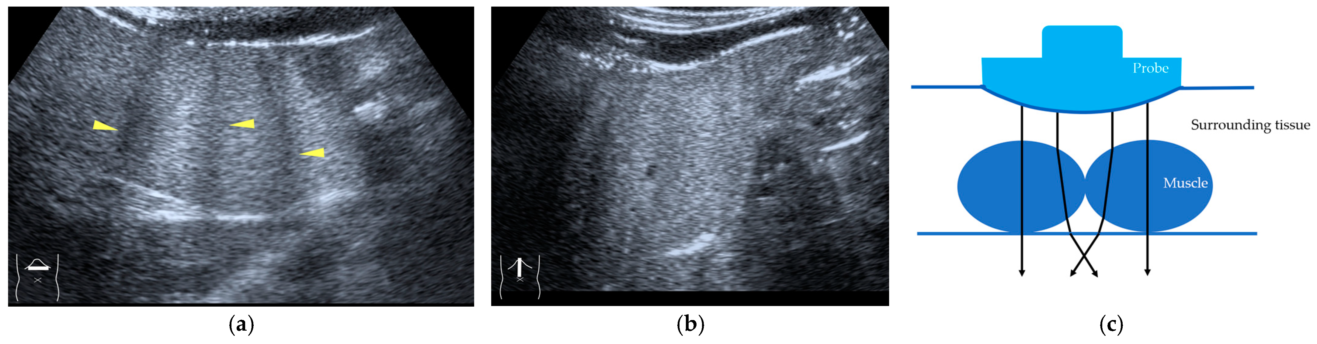 Diagnostics 14 01817 g005