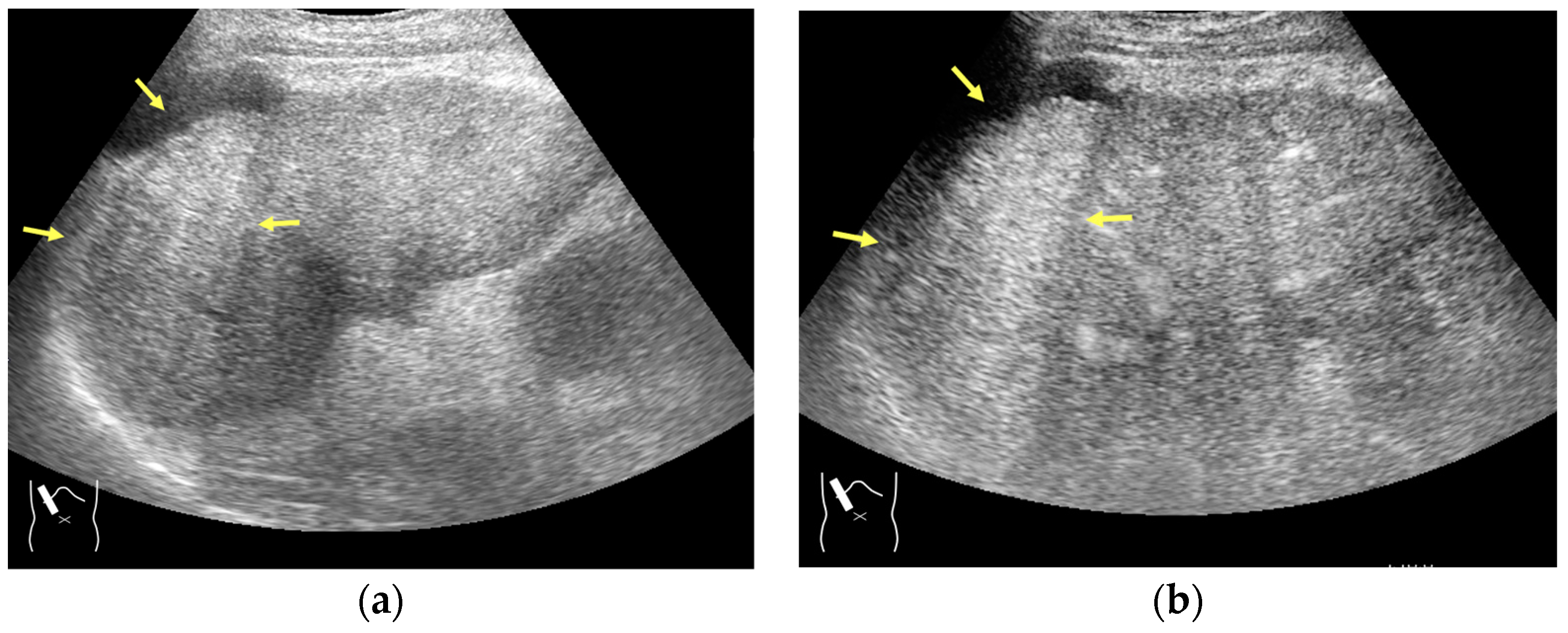 Diagnostics 14 01817 g009