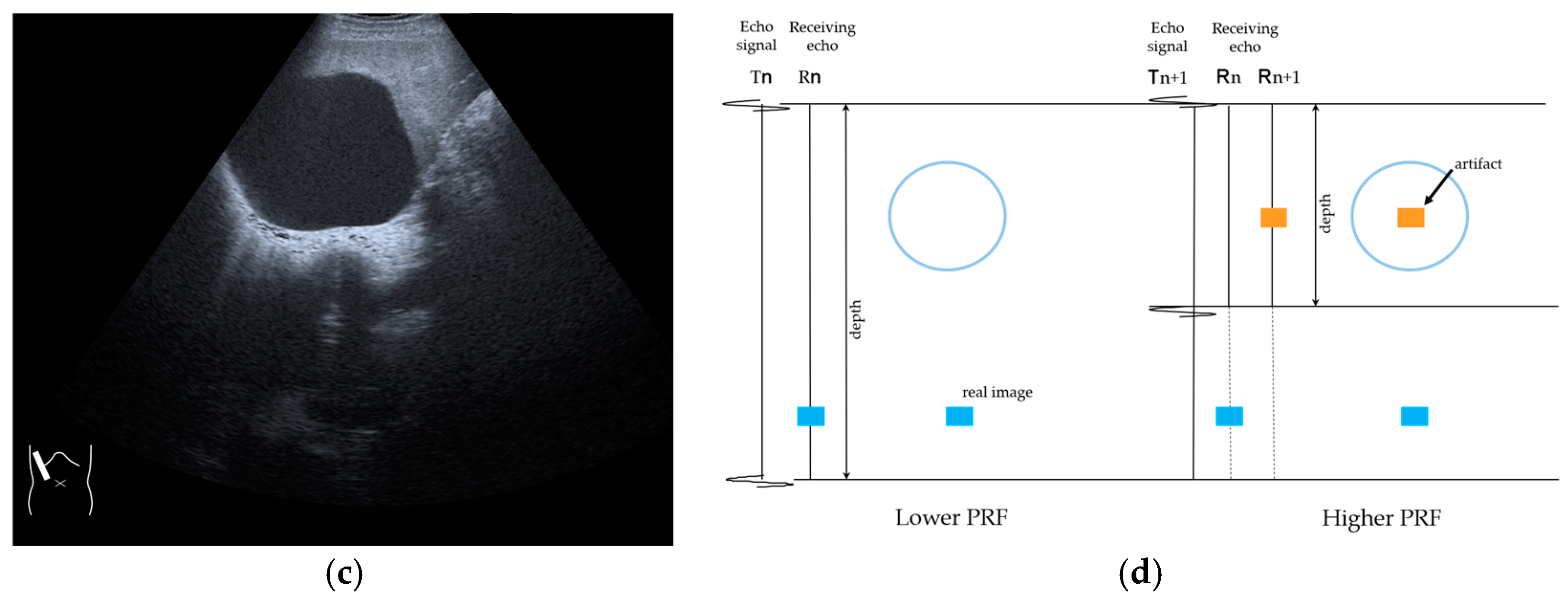 Diagnostics 14 01817 g010b