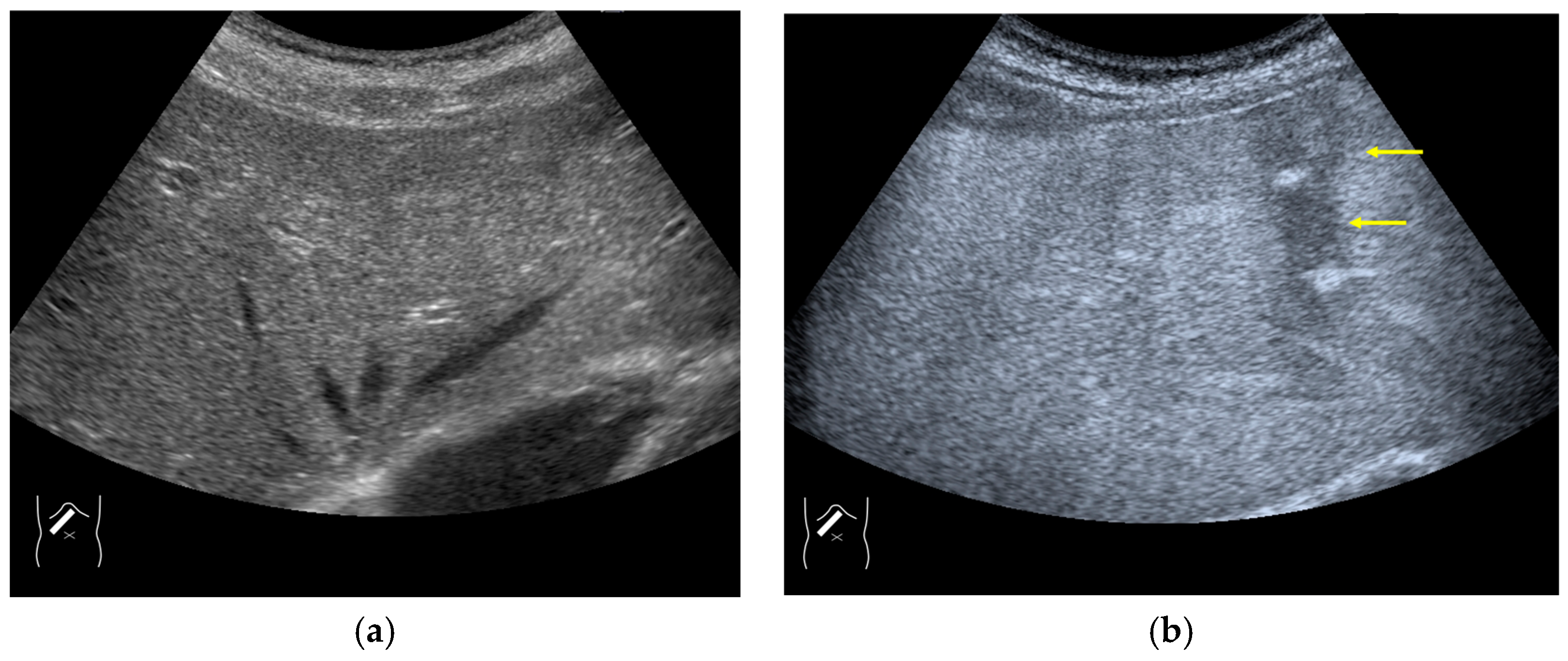 Diagnostics 14 01817 g011