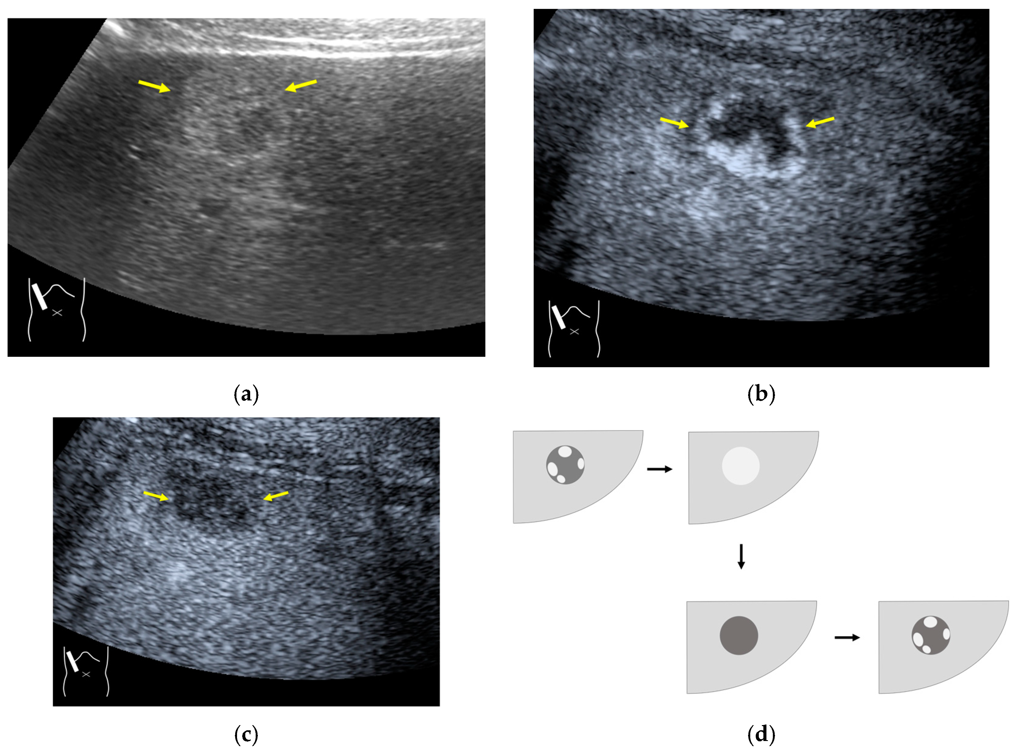 Diagnostics 14 01817 g012