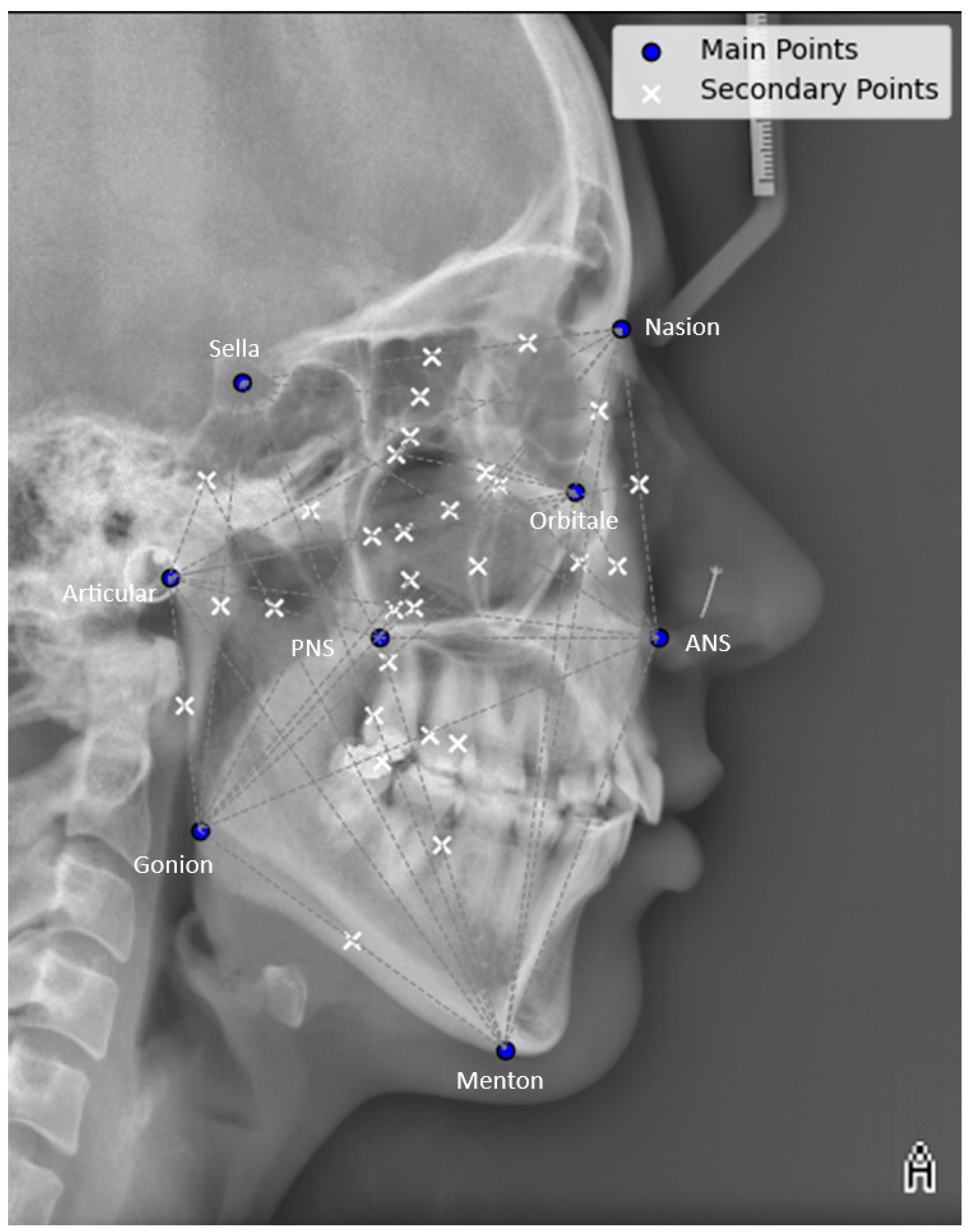 Diagnostics 14 01840 g002 Diagnostics 14 01840 g002
