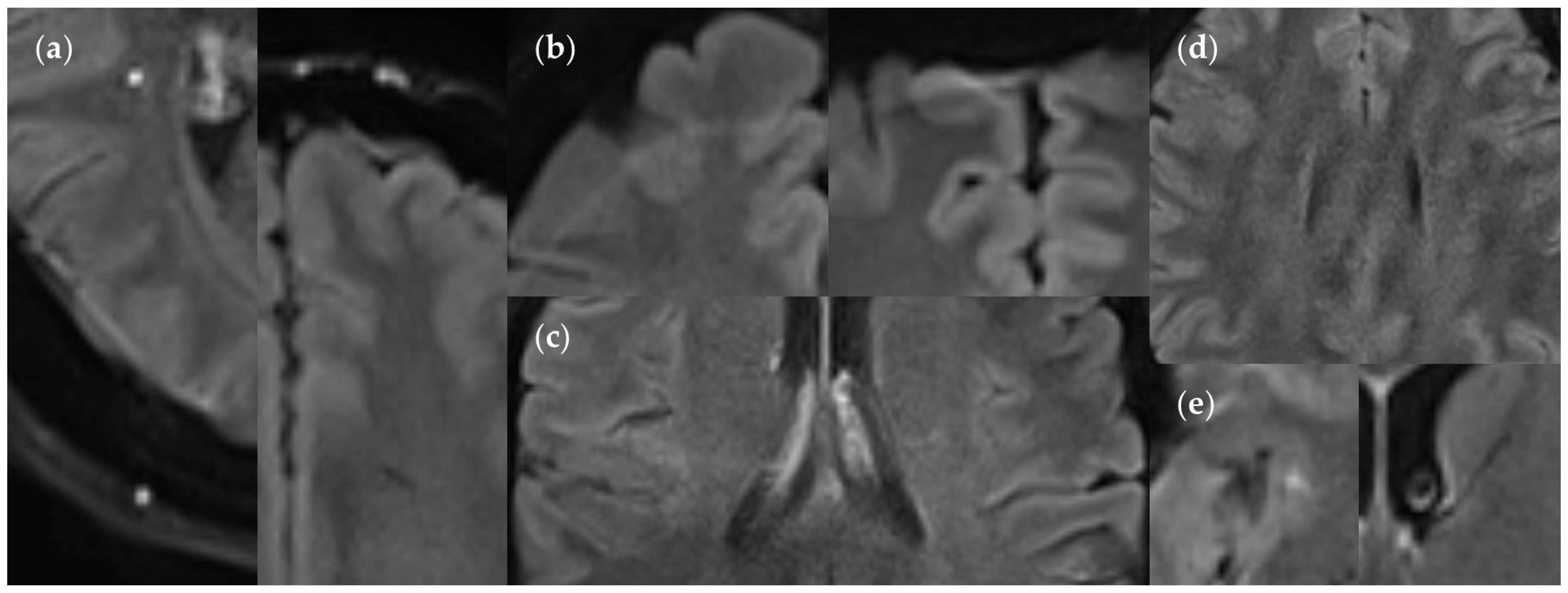 Diagnostics 14 01841 g016