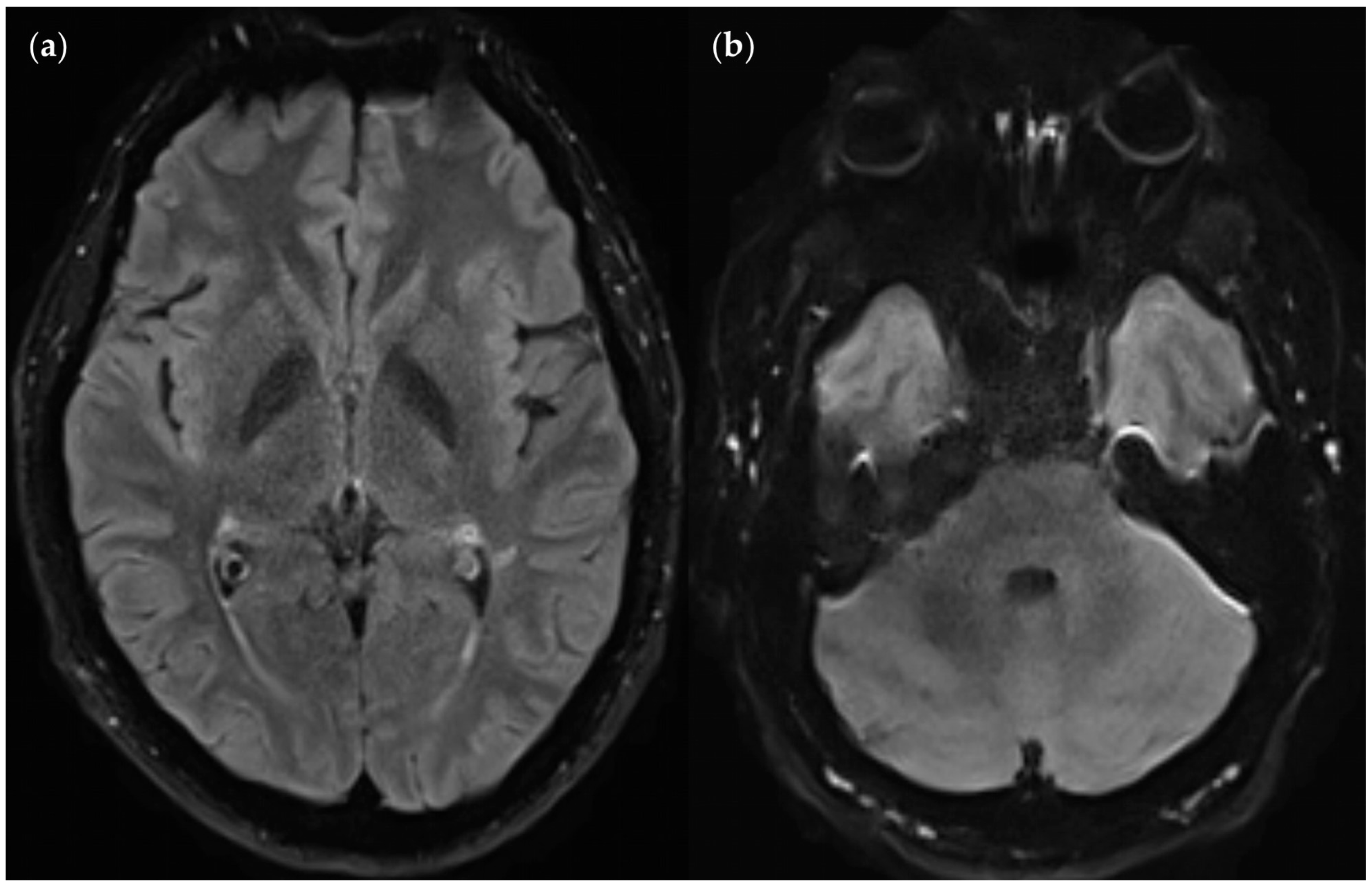 Diagnostics 14 01841 g018