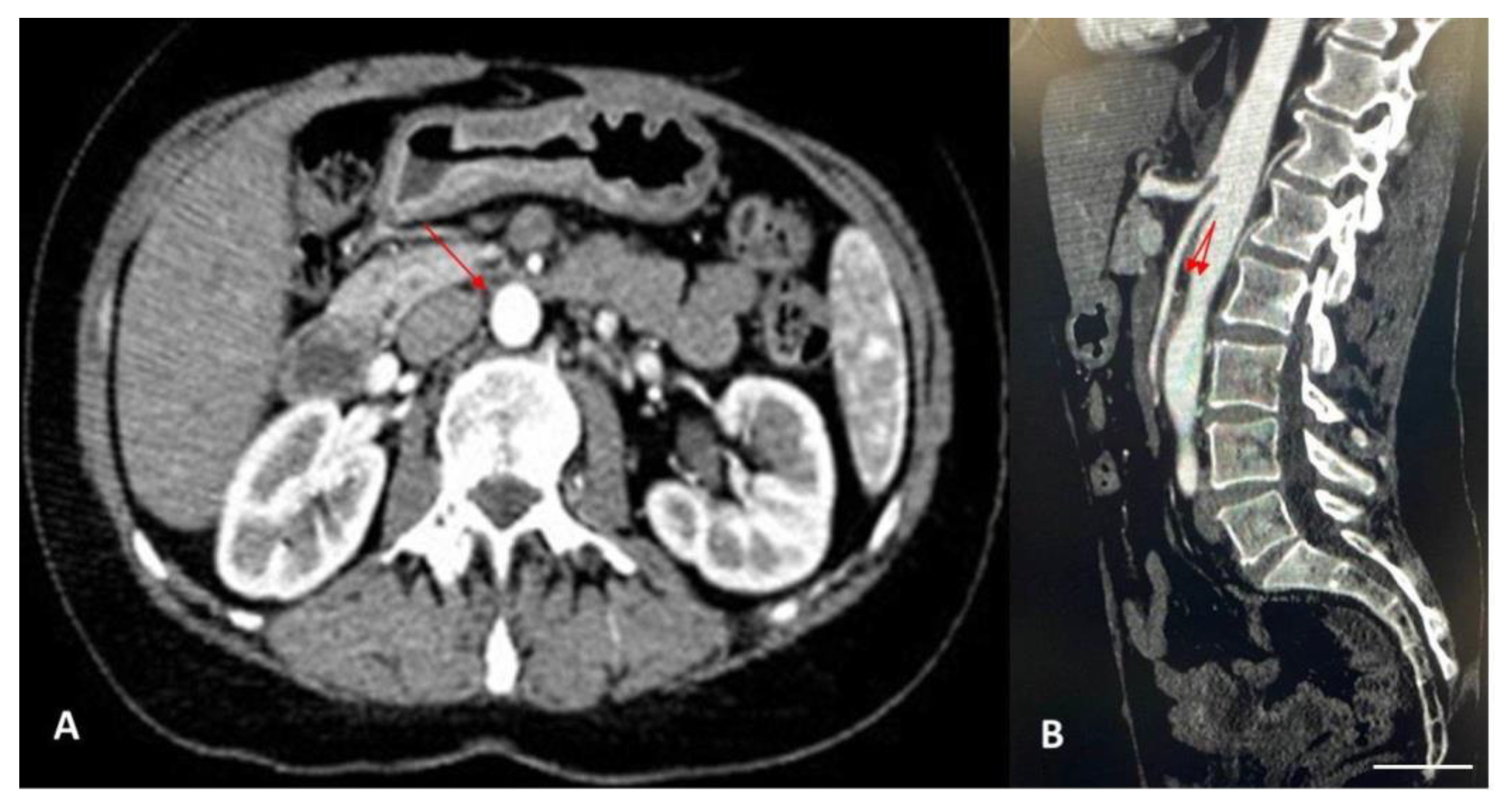 Diagnostics 14 01844 g002