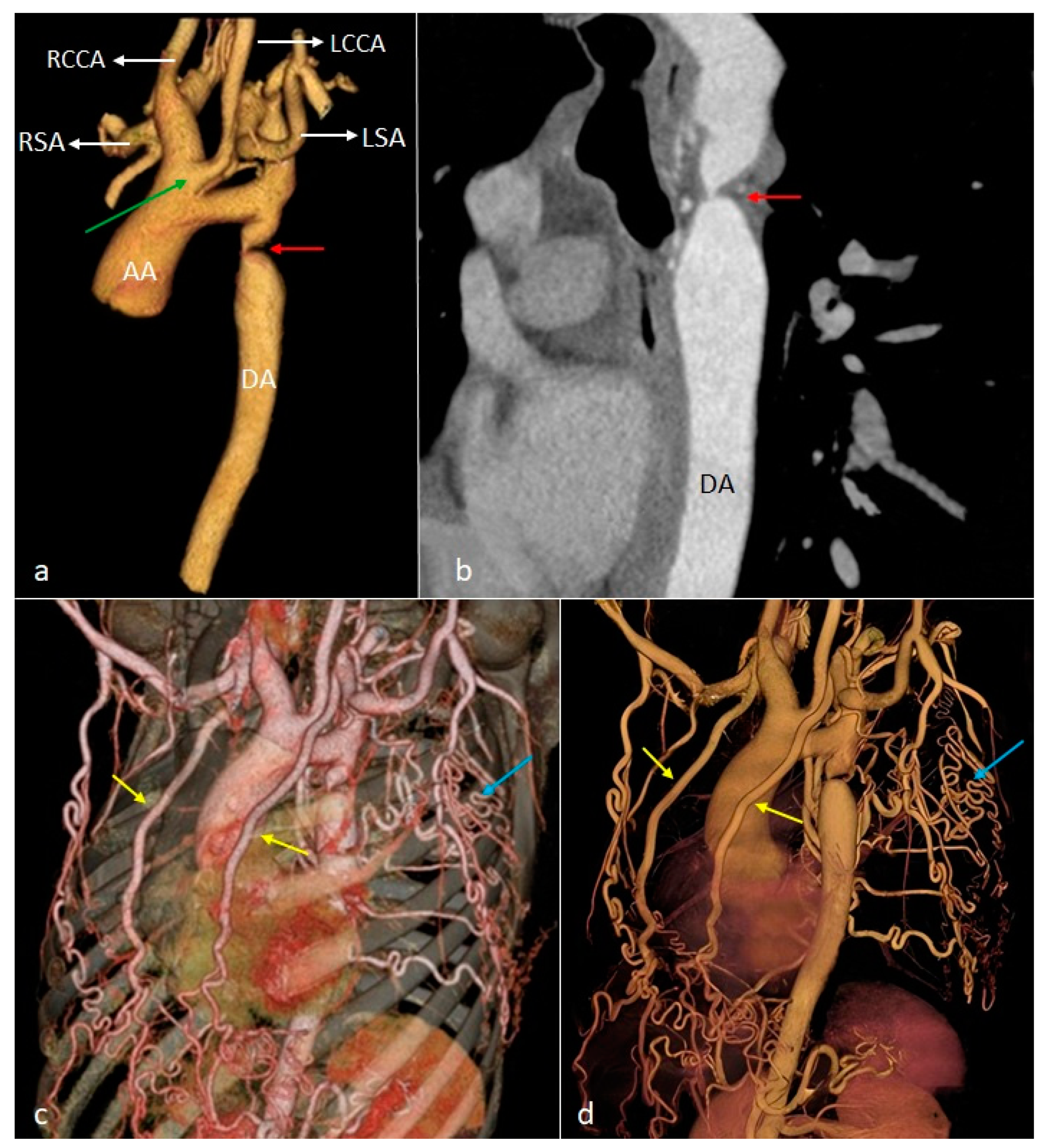 Diagnostics 14 01851 g008 Diagnostics 14 01851 g008