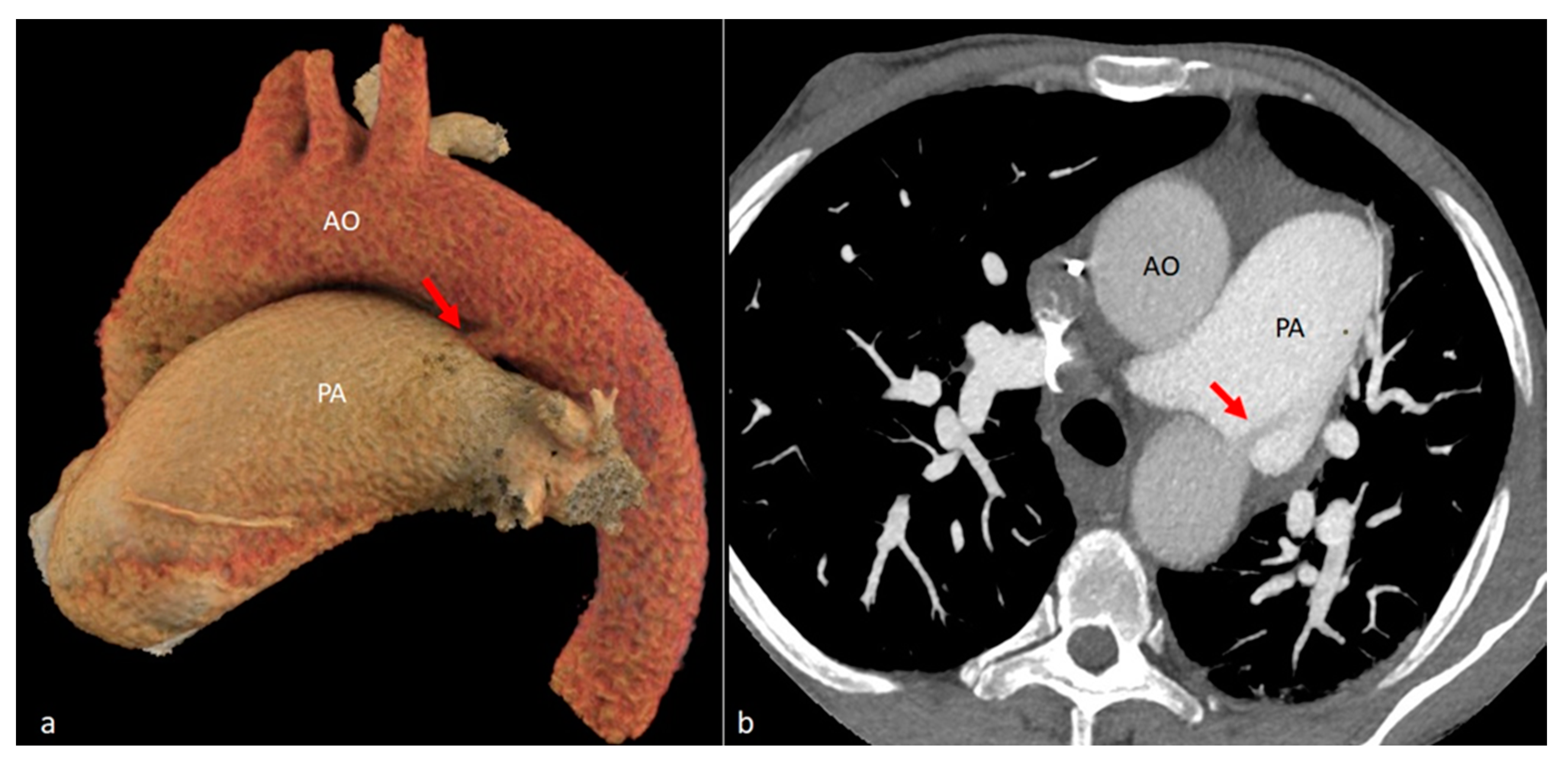 Diagnostics 14 01851 g011 Diagnostics 14 01851 g011