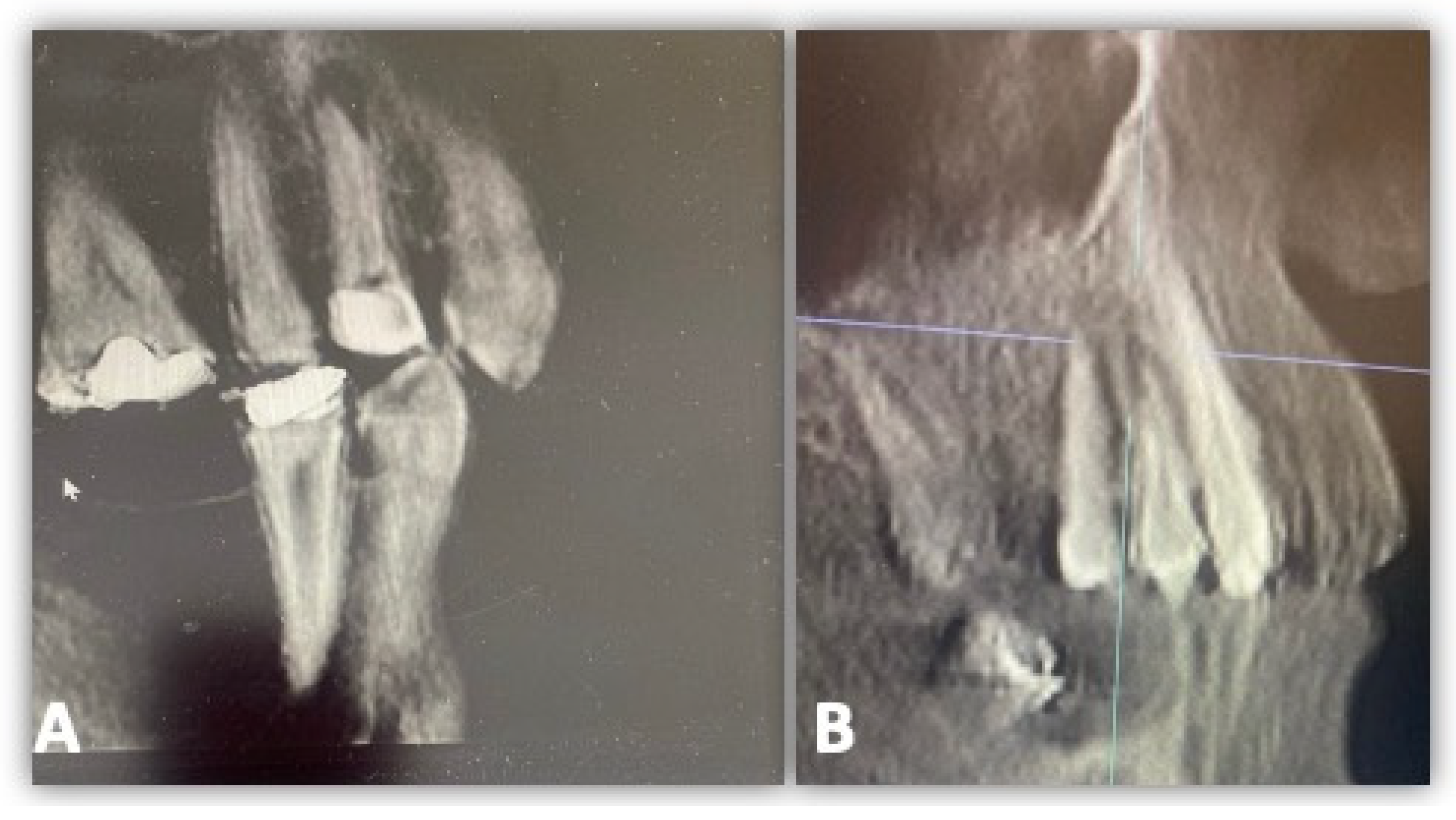 Diagnostics 14 01872 g002