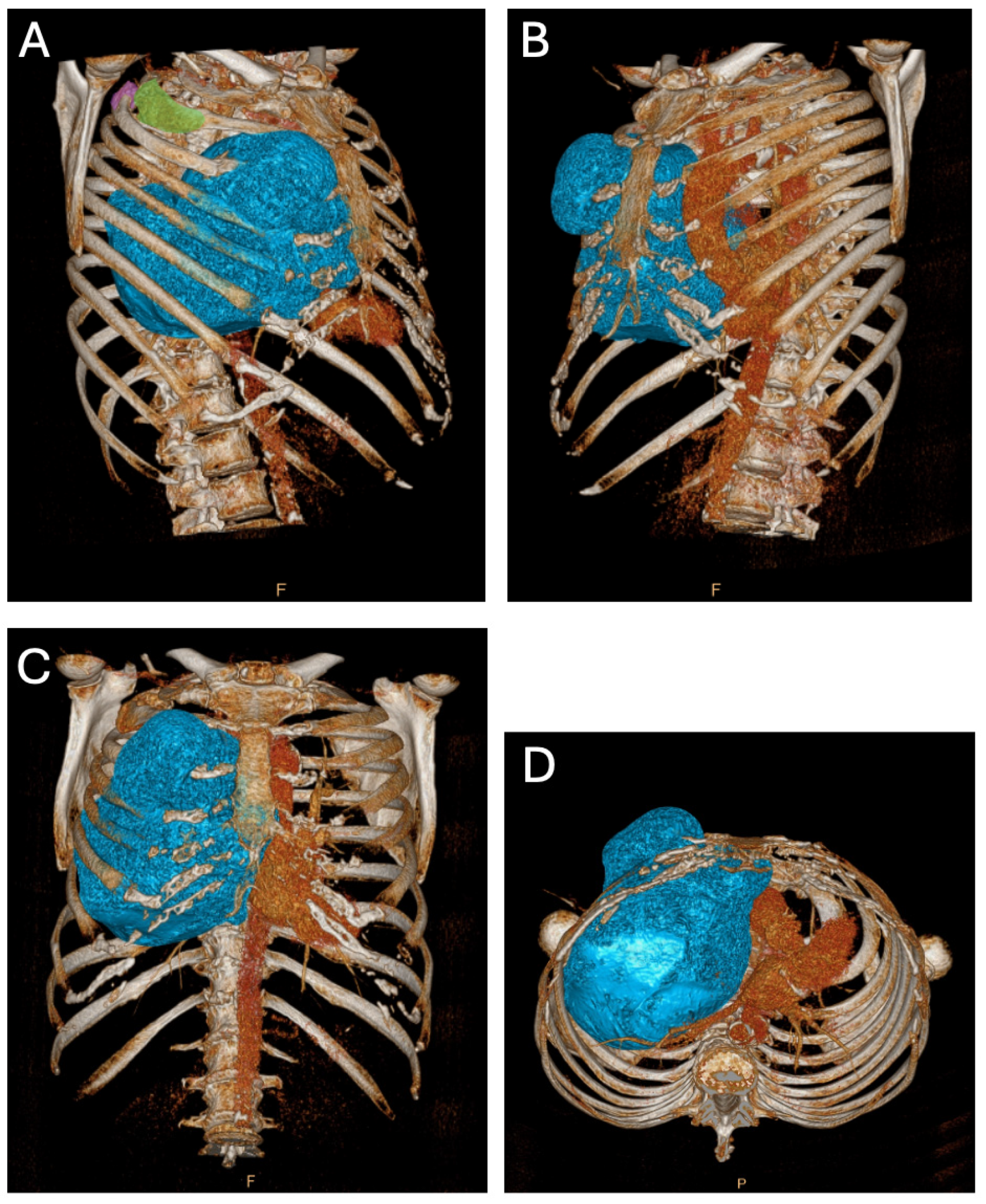 Diagnostics 14 01873 g002