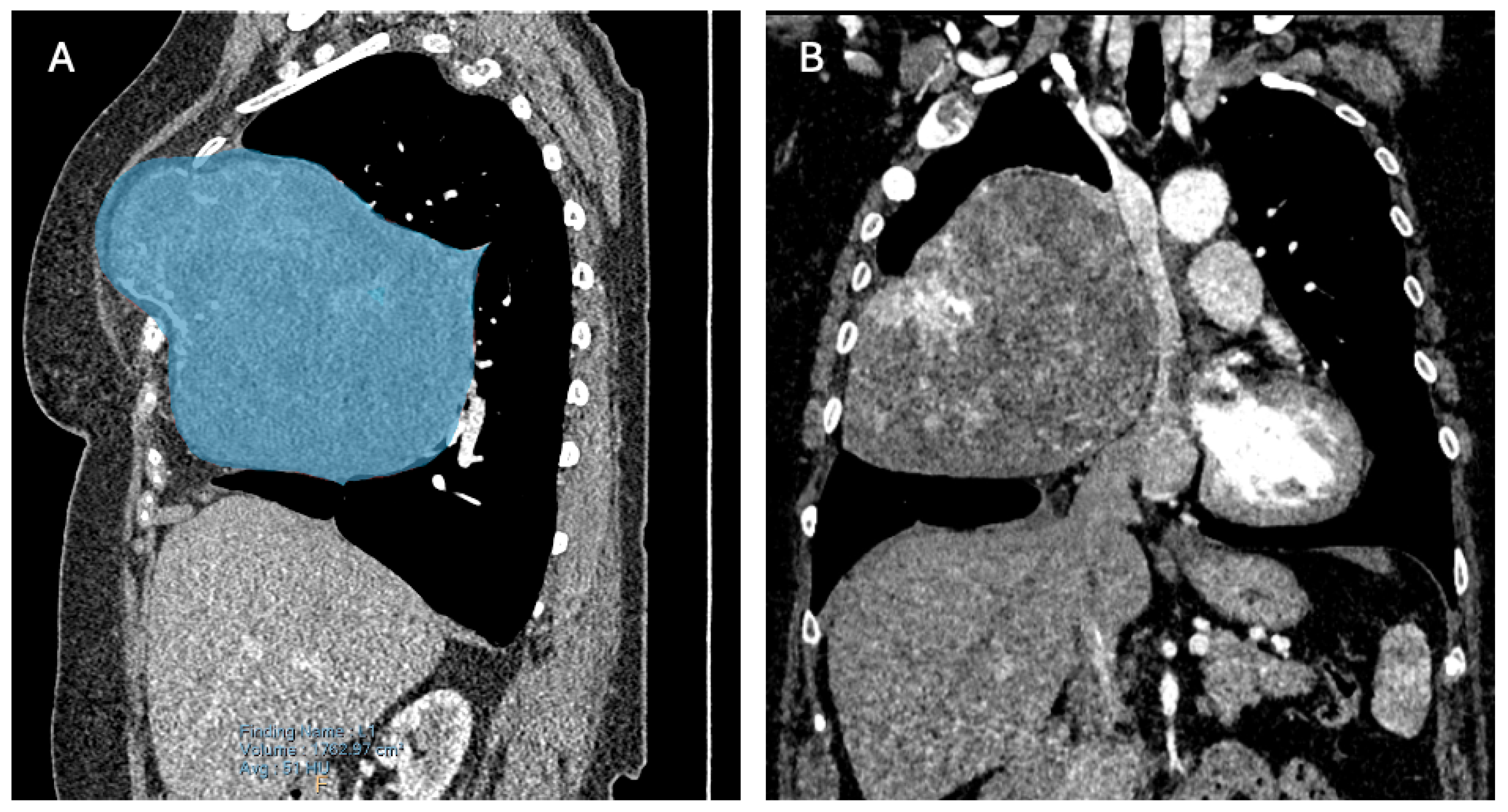 Diagnostics 14 01873 g003