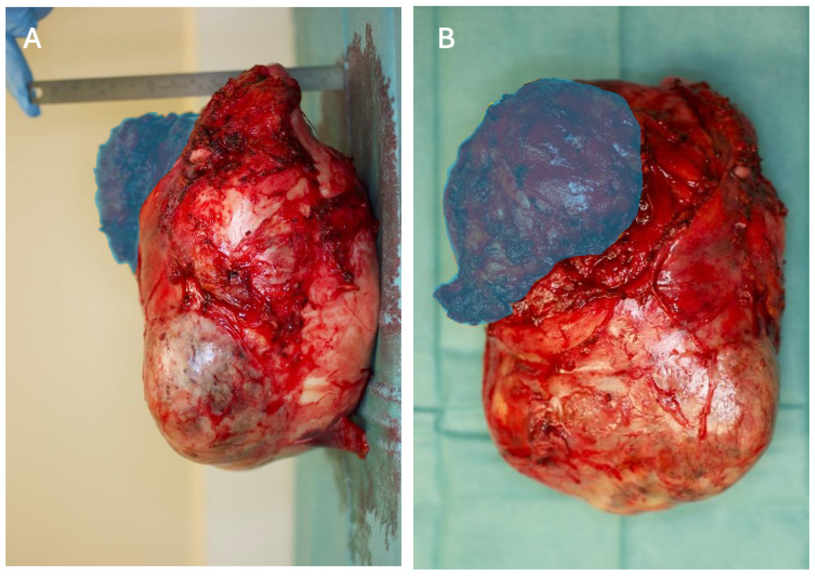 Diagnostics 14 01873 g005