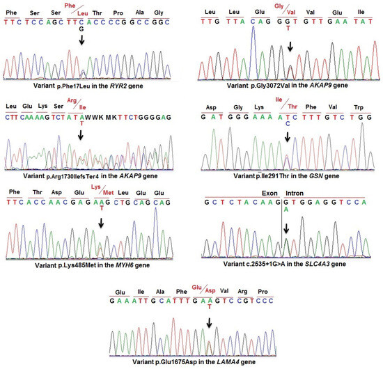 Identifying the Pathogenic Variants in Heart Genes in Vietnamese Sudden Unexplained Death Victims by Next Generation Sequencing