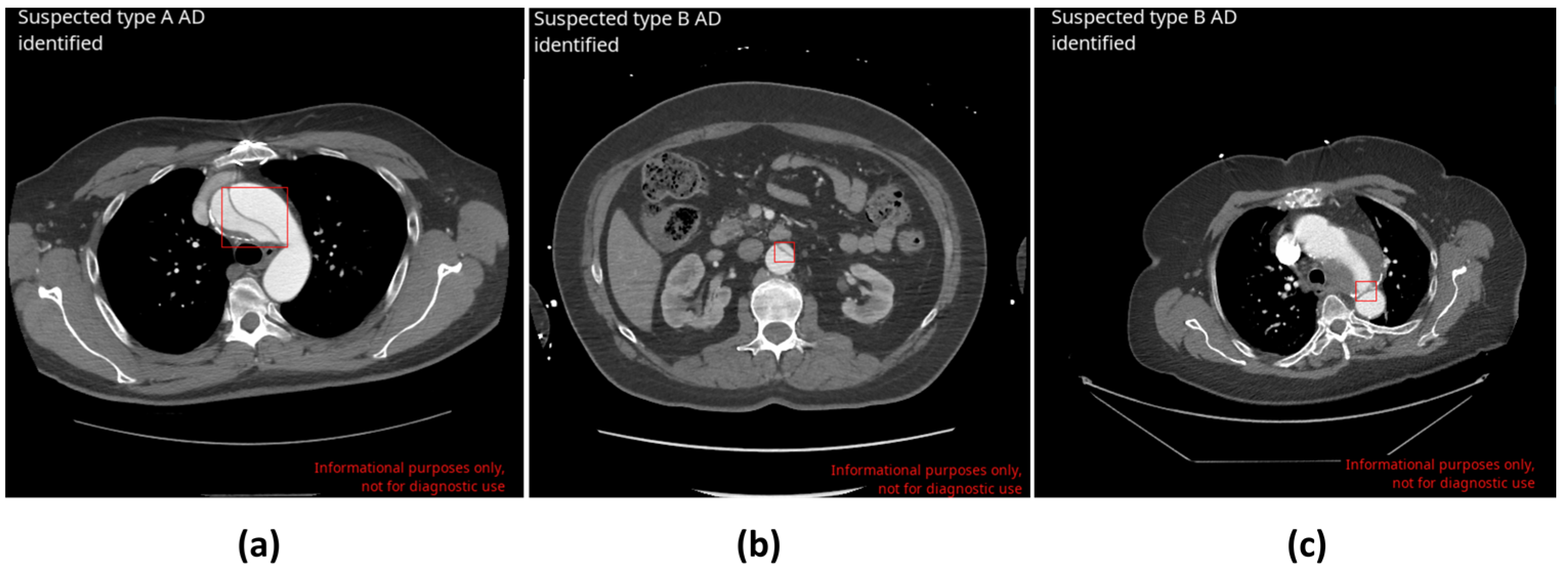 Diagnostics 14 01877 g001
