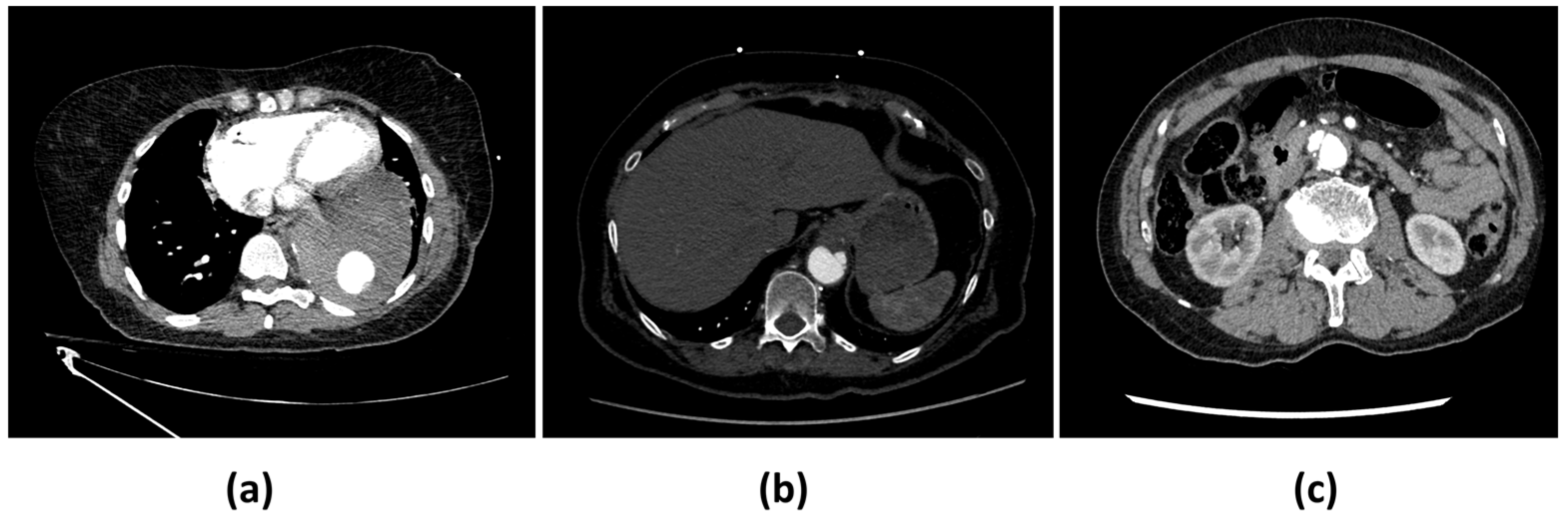 Diagnostics 14 01877 g002