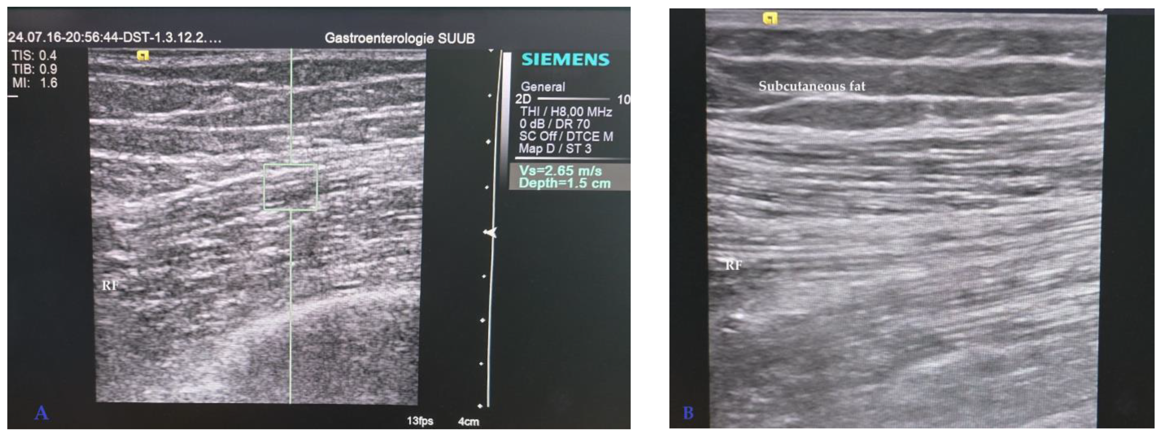 Diagnostics 14 01891 g001
