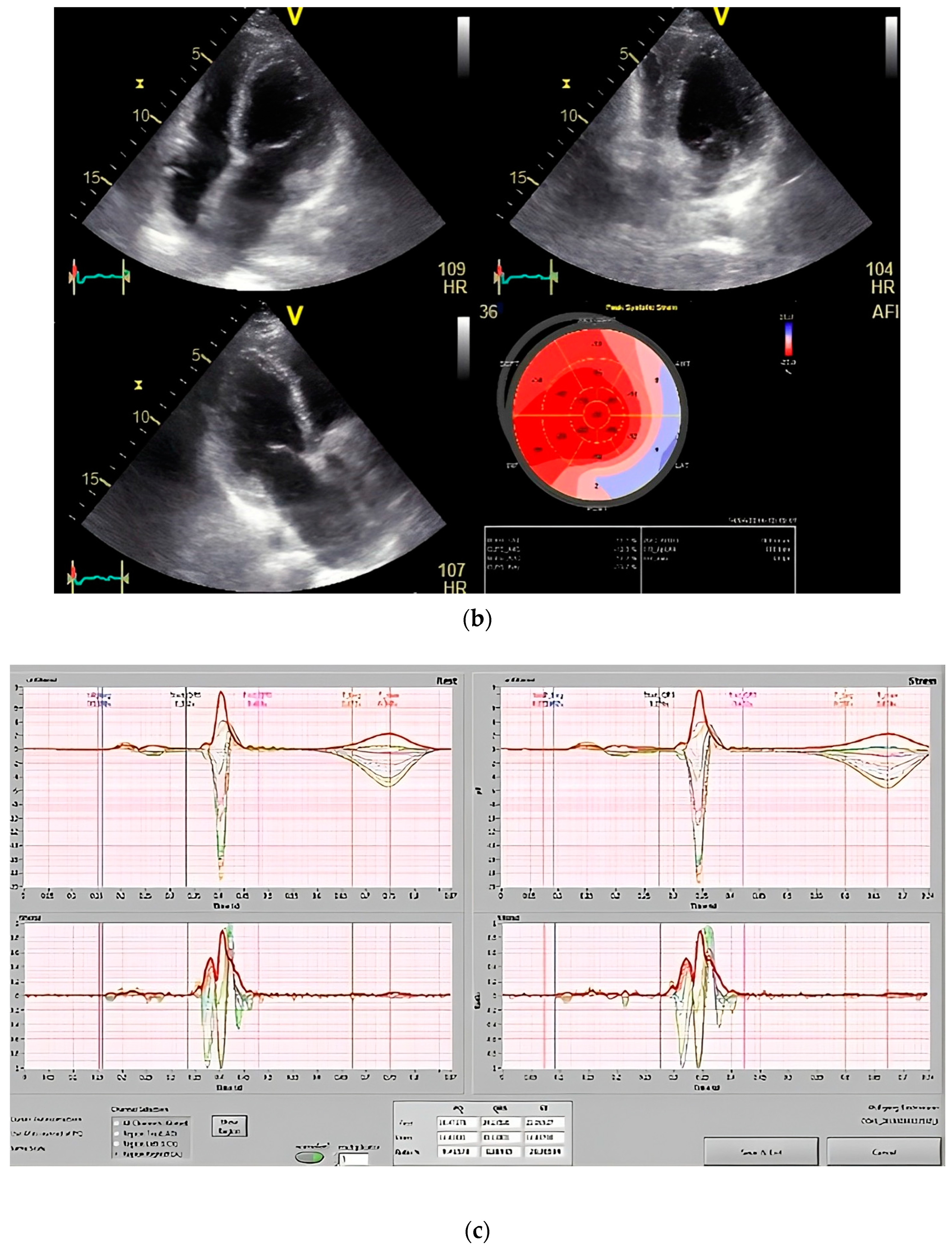 Diagnostics 14 01893 g005b