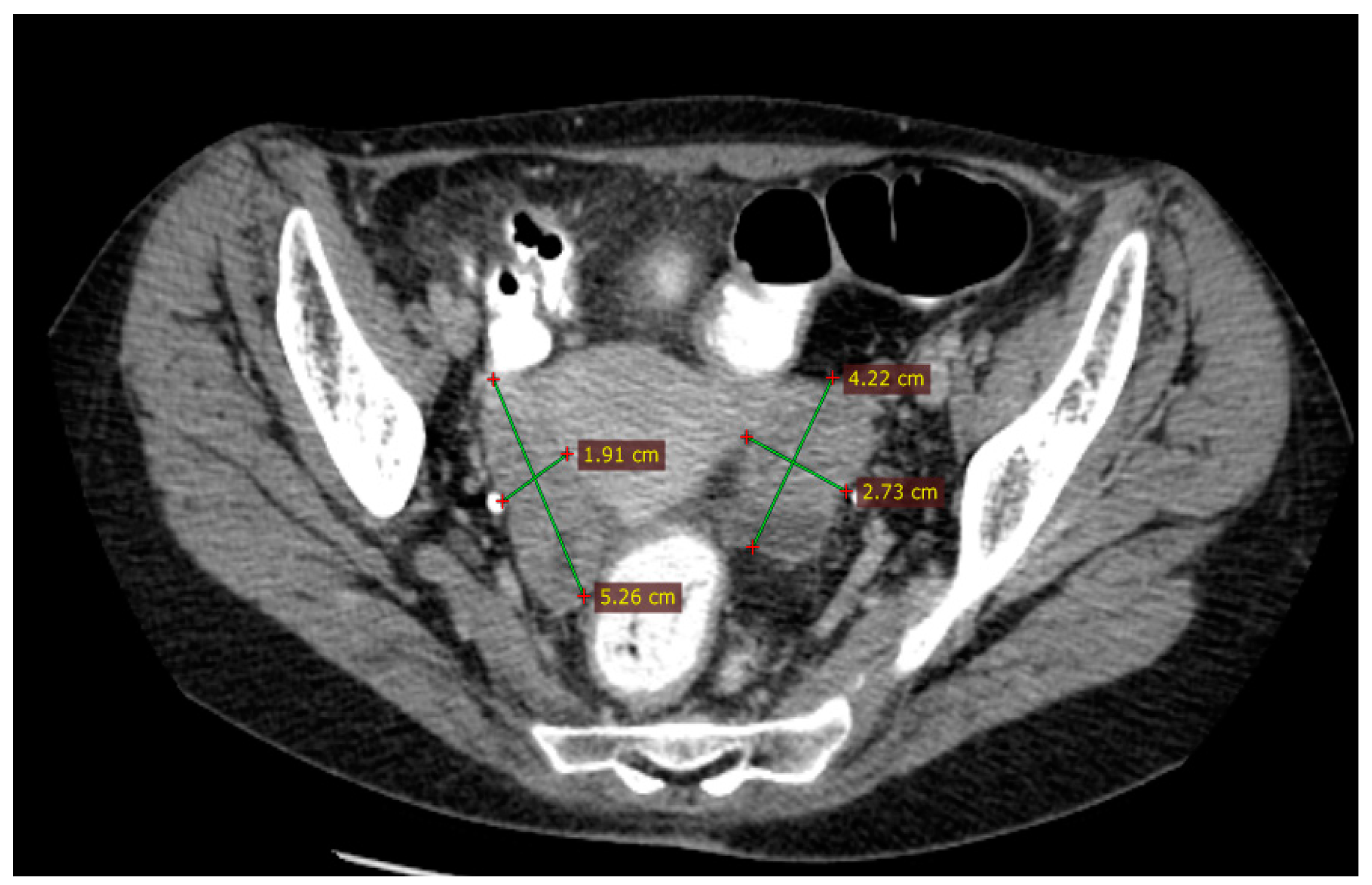 Diagnostics 14 01898 g002