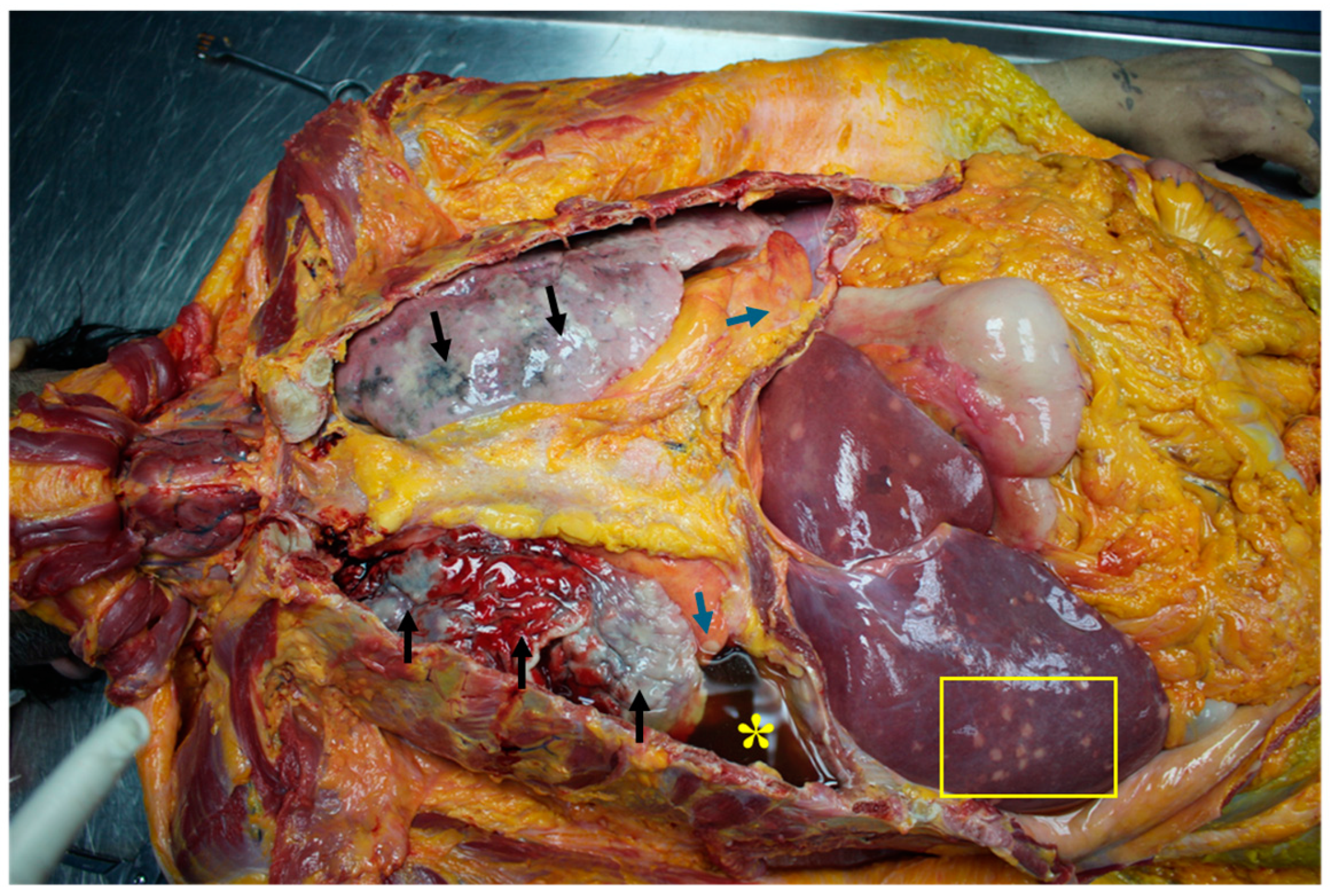 Diagnostics 14 01901 g001