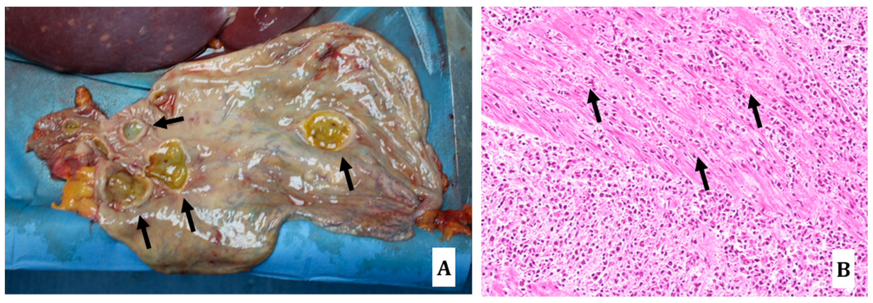 Diagnostics 14 01901 g005