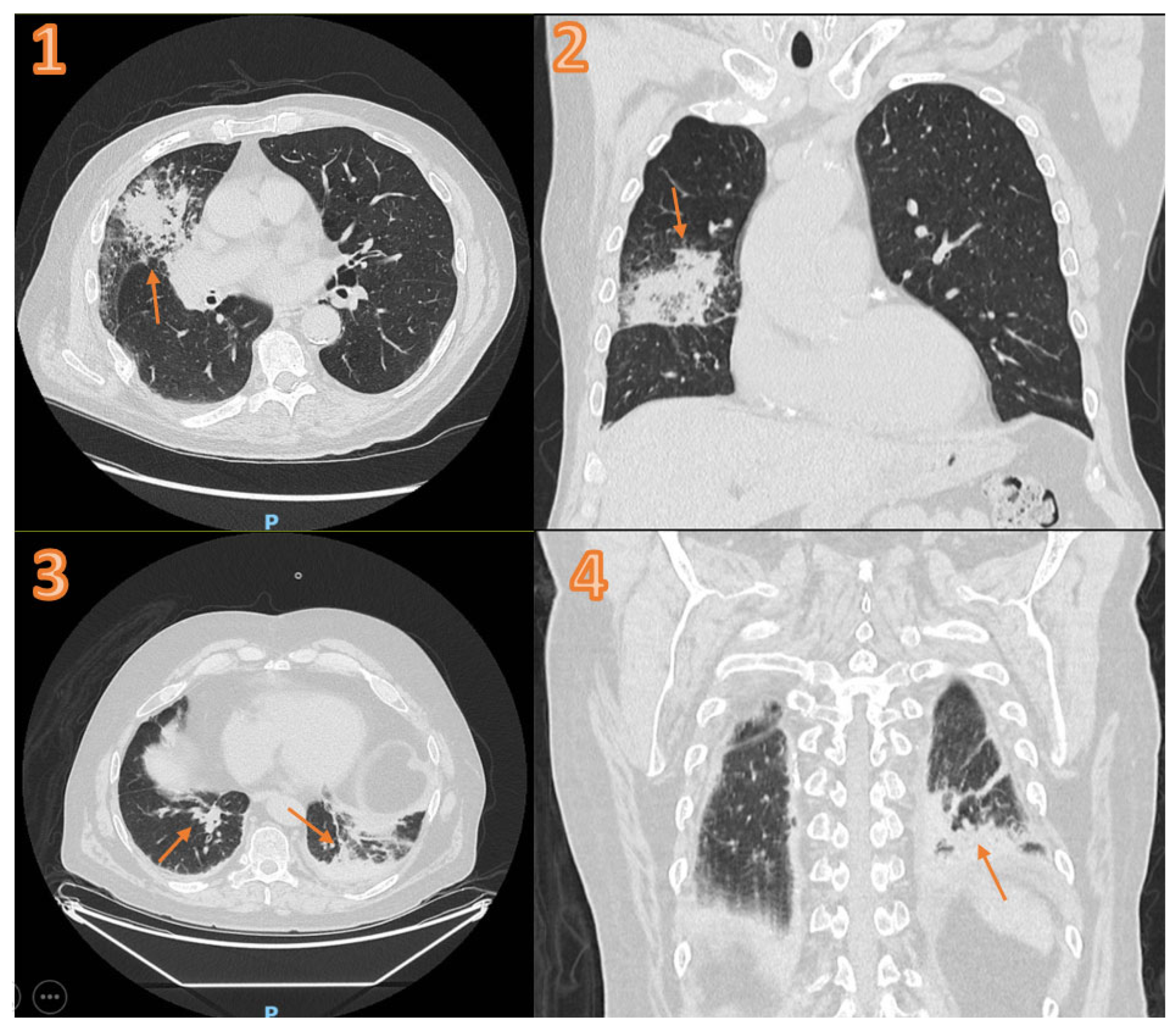 Diagnostics 14 01921 g002