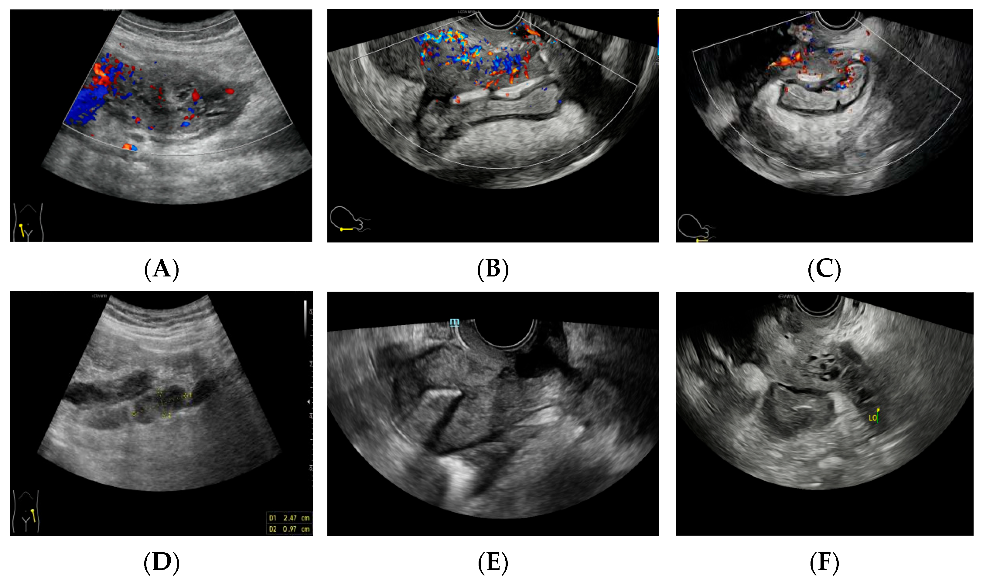 Diagnostics 14 01923 g003