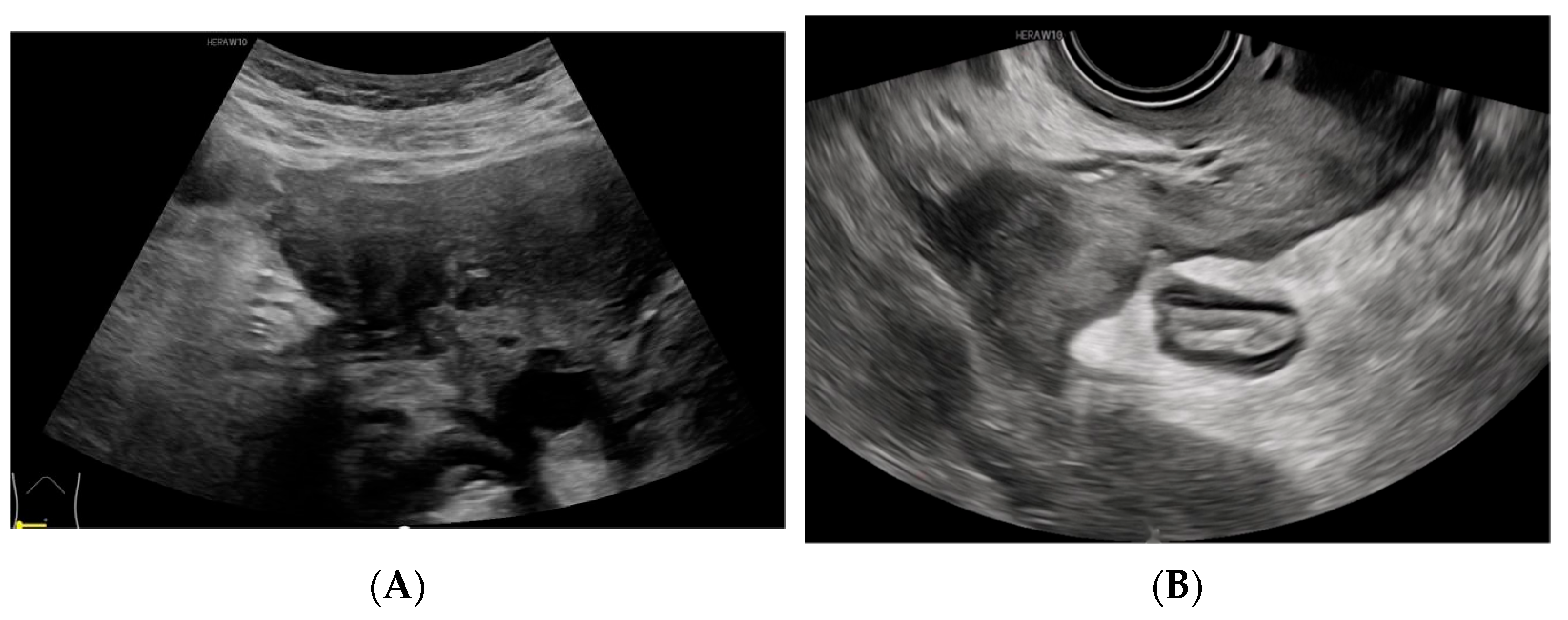 Diagnostics 14 01923 g004