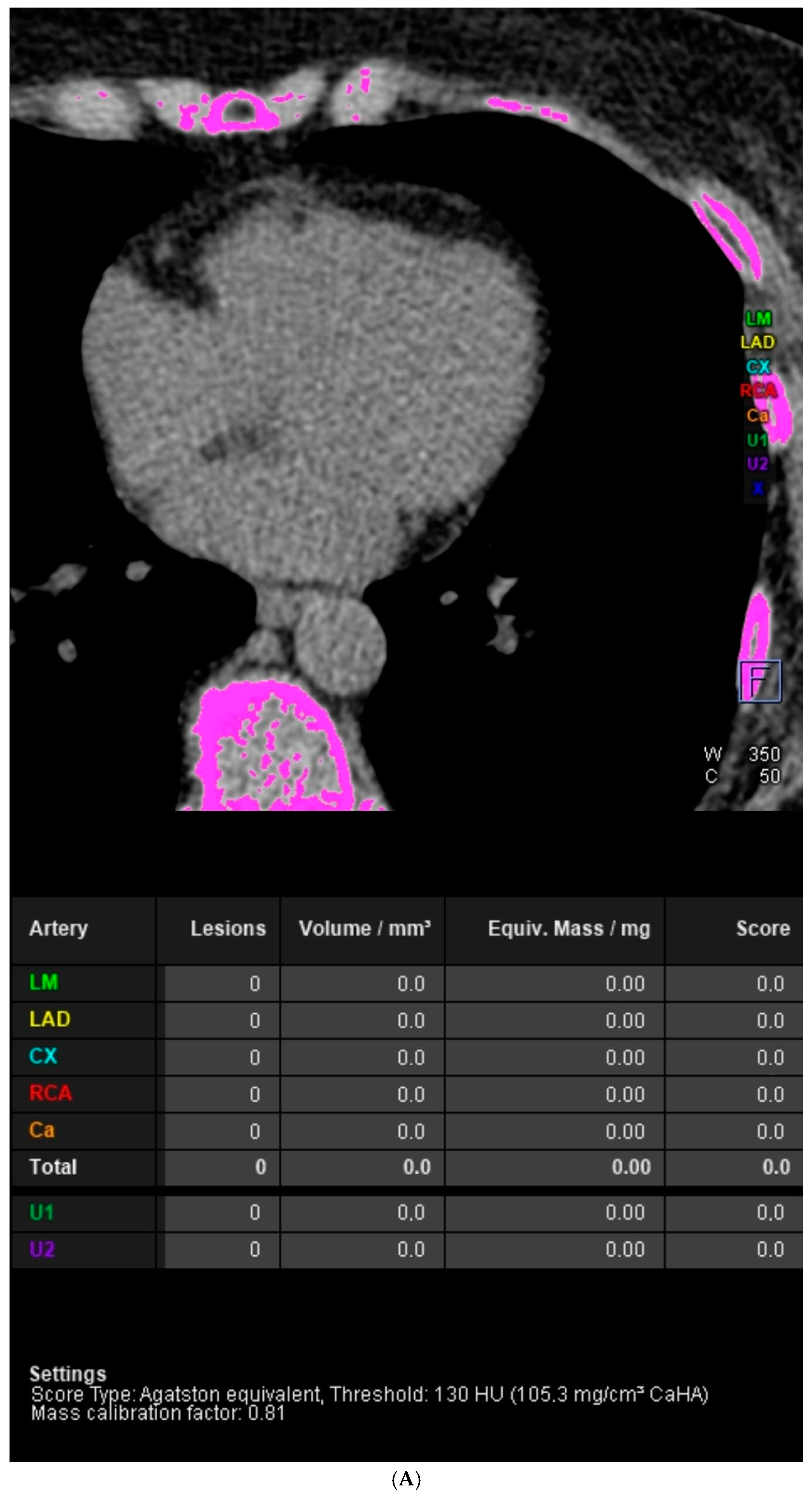 Diagnostics 14 01928 g001a Diagnostics 14 01928 g001a