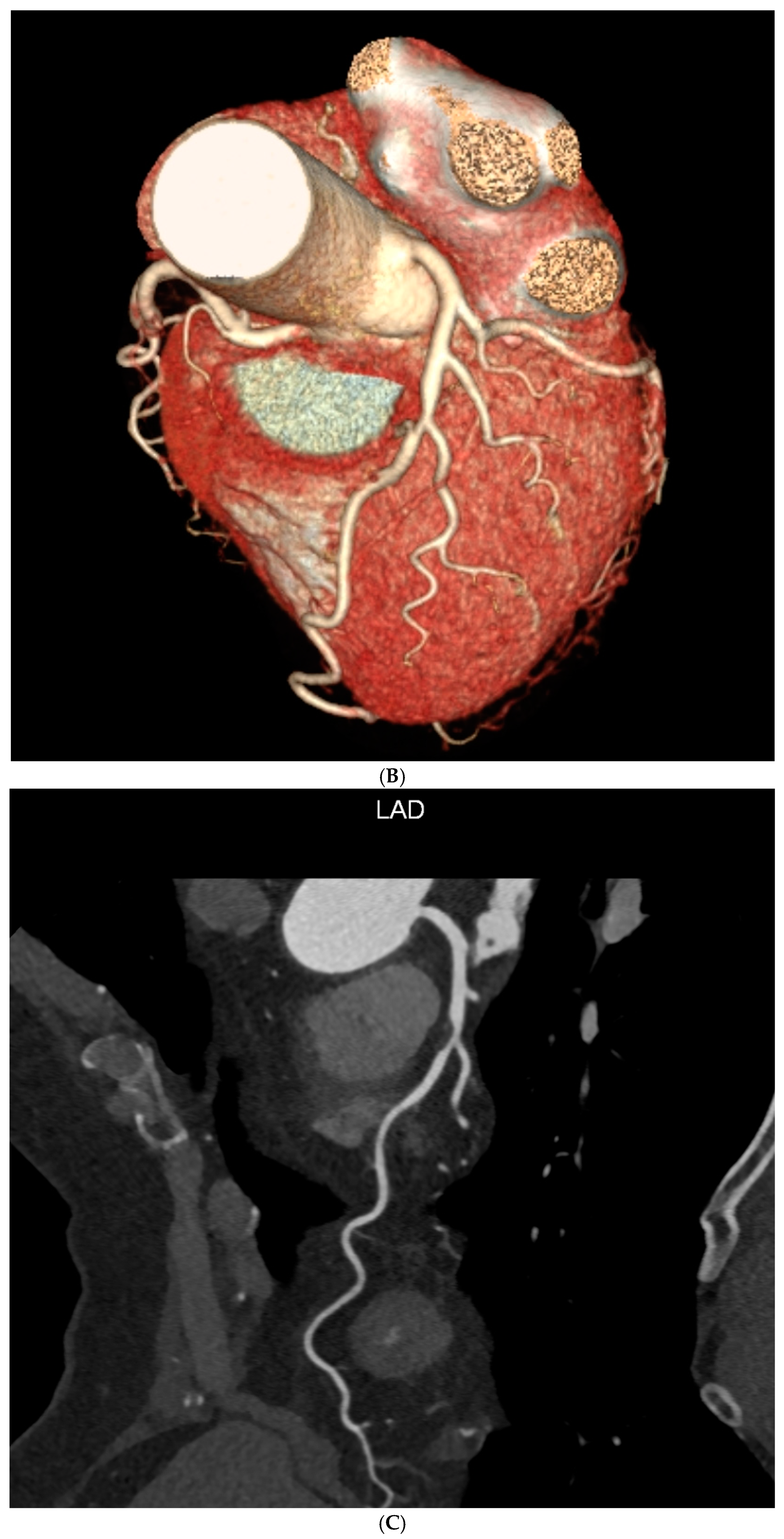 Diagnostics 14 01928 g001b Diagnostics 14 01928 g001b